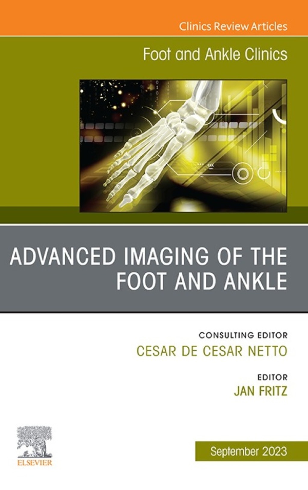 Advanced Imaging of the Foot and Ankle, An issue of Foot and Ankle ...