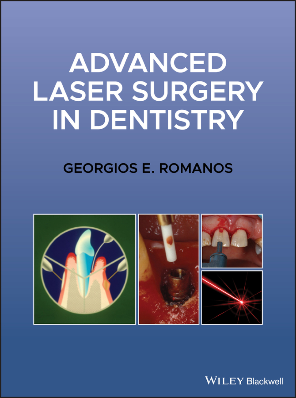 Advanced Laser Surgery in Dentistry 1st Edition â€“ PDF/EPUB Version Downloadable