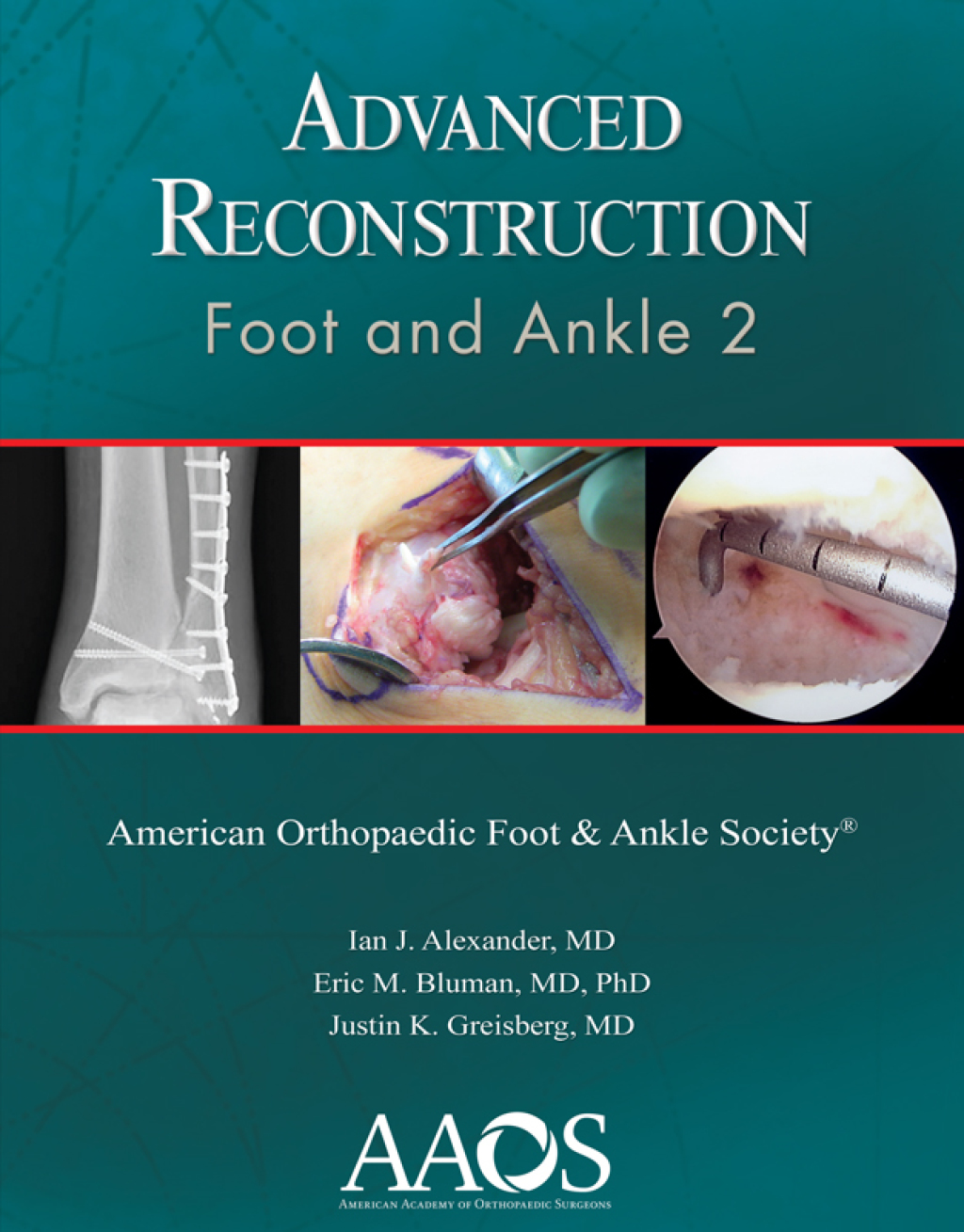 Advanced Reconstruction: Foot and Ankle 2 â€“ PDF/EPUB Version Downloadable