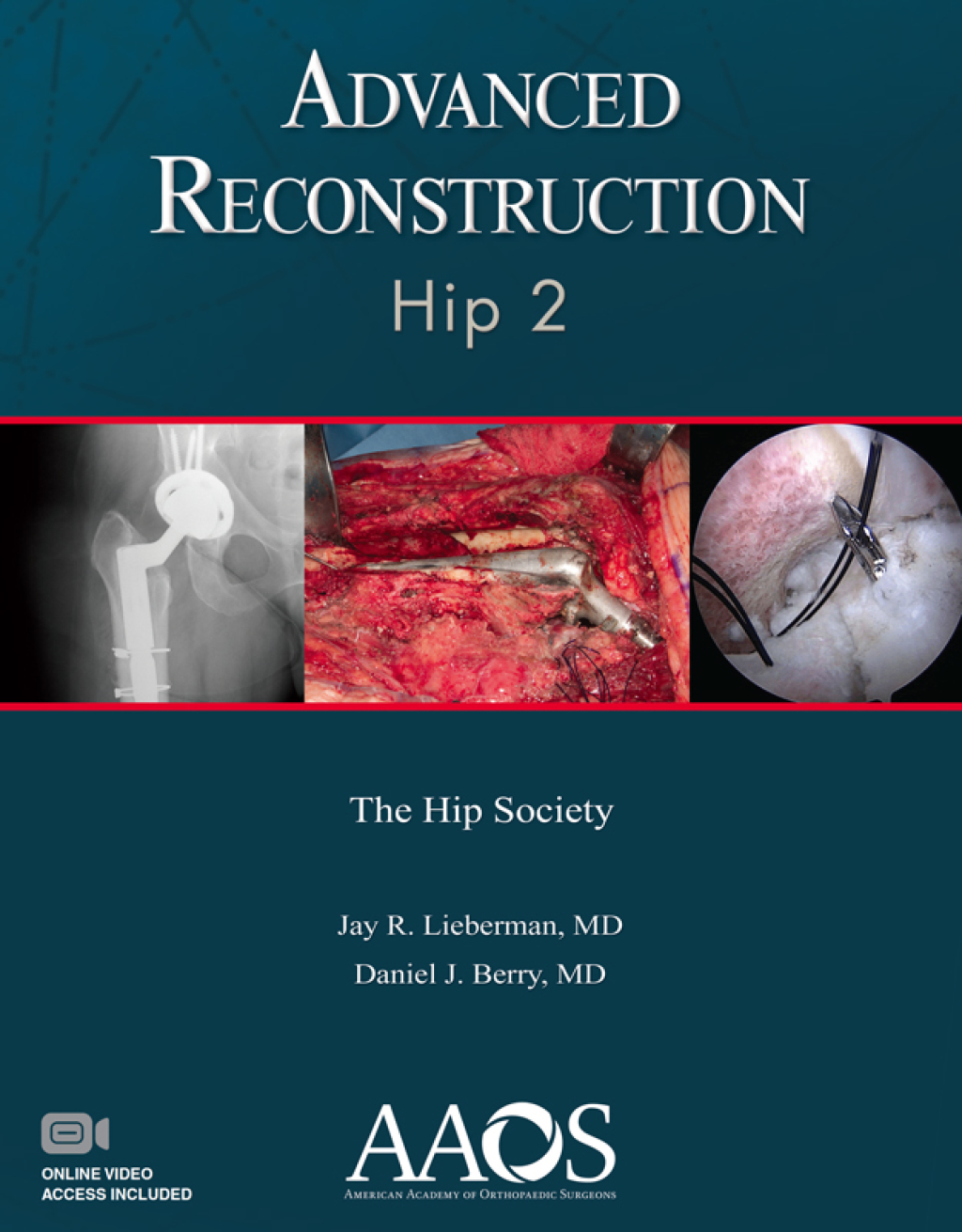 Advanced Reconstruction: Hip 2 â€“ PDF/EPUB Version Downloadable