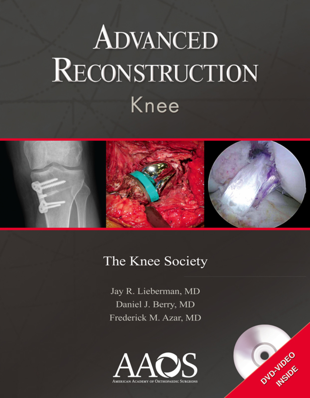 Advanced Reconstruction: Knee â€“ PDF/EPUB Version Downloadable