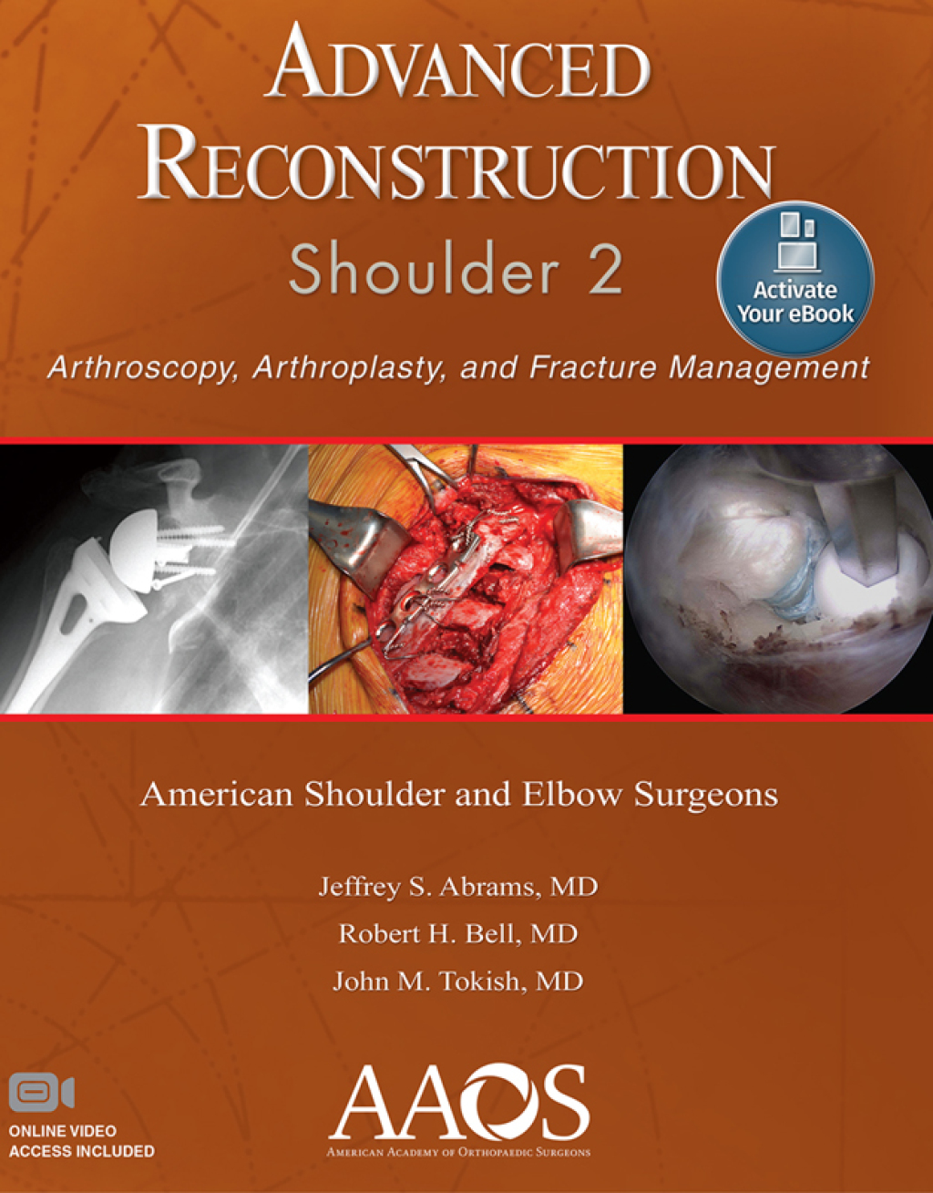 Advanced Reconstruction: Shoulder 2 â€“ PDF/EPUB Version Downloadable