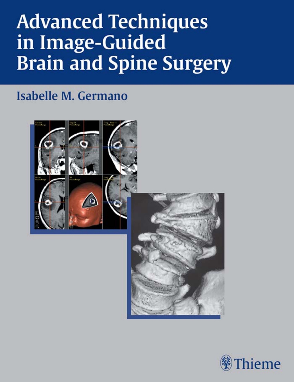 Advanced Techniques in Image-Guided Brain and Spine Surgery 1st Edition â€“ PDF/EPUB Version Downloadable
