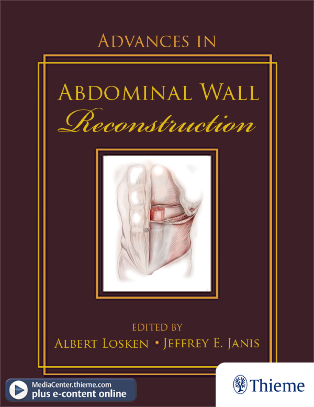 Advances in Abdominal Wall Reconstruction 1st Edition â€“ PDF/EPUB Version Downloadable