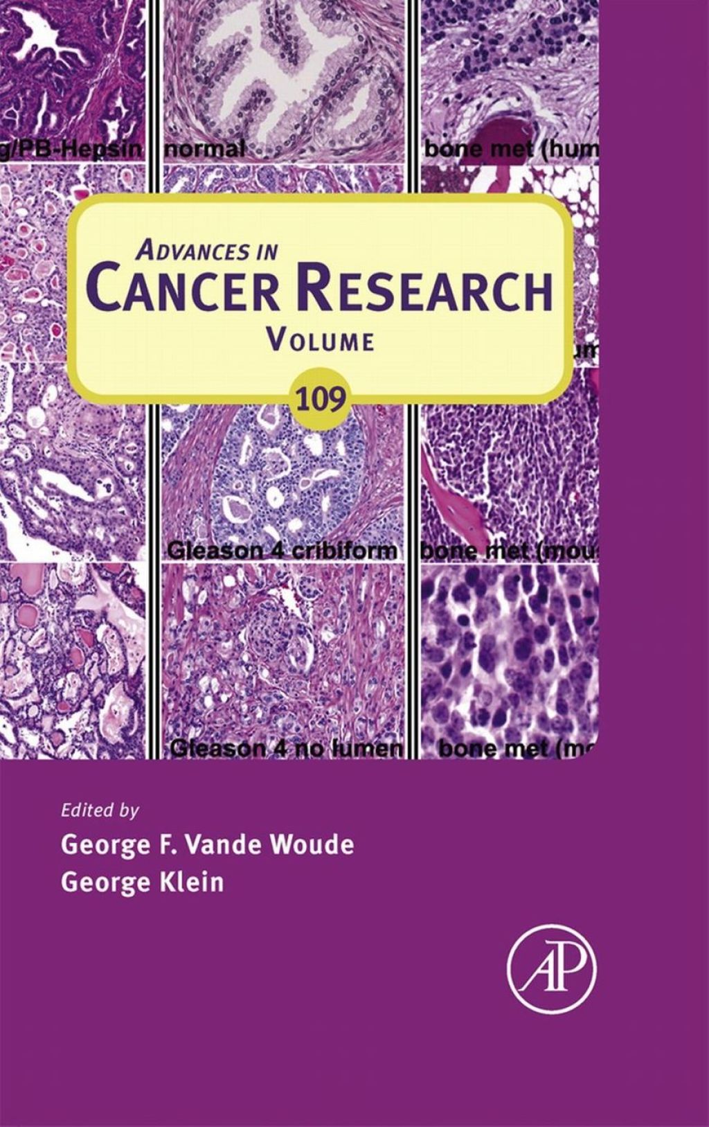 Advances in Cancer Research â€“ PDF/EPUB Version Downloadable