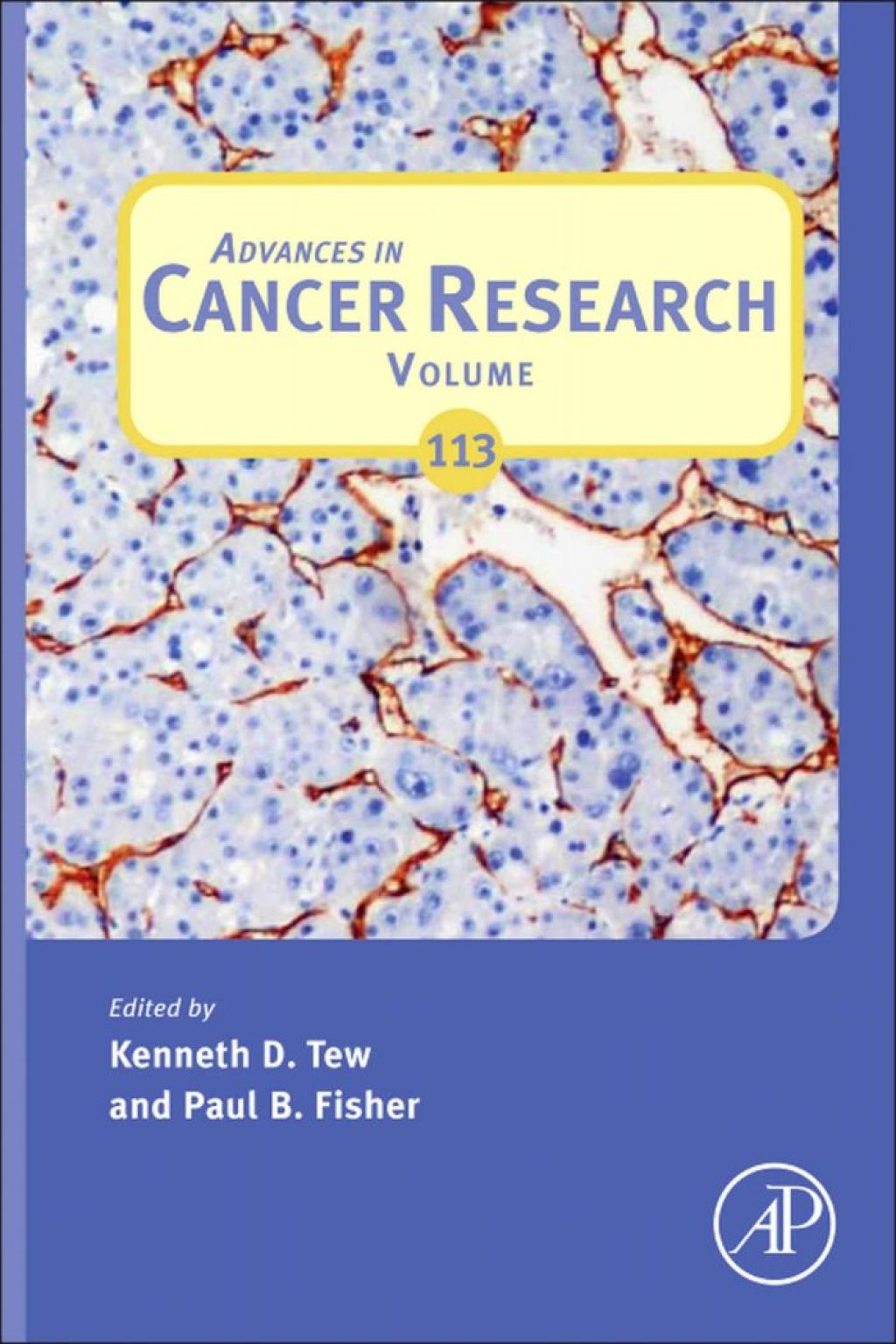 Advances in Cancer Research â€“ PDF/EPUB Version Downloadable