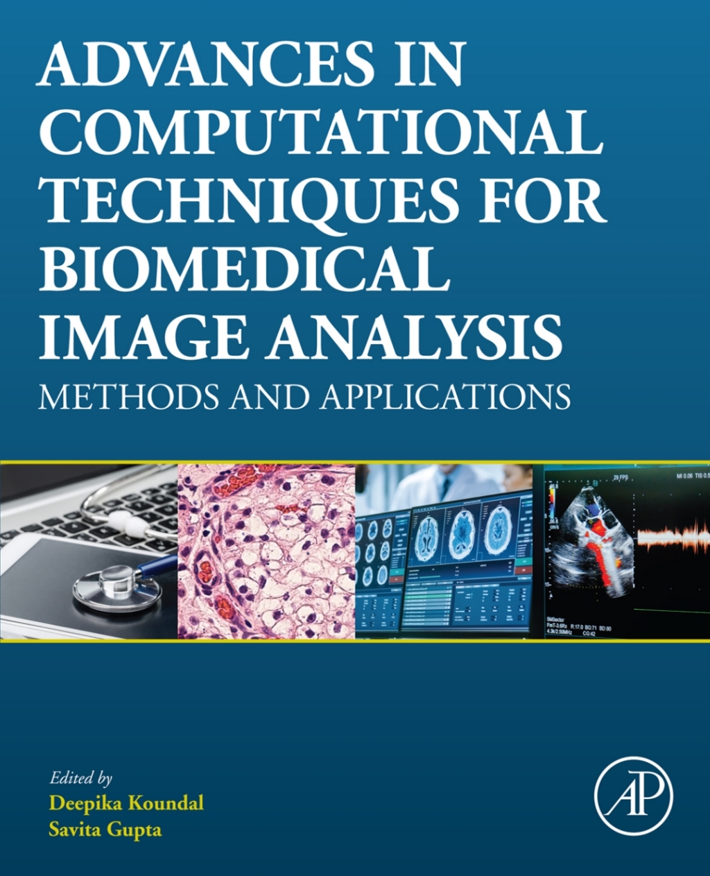 Advances in Computational Techniques for Biomedical Image Analysis Methods and Applications 1st Edition â€“ PDF/EPUB Version Downloadable