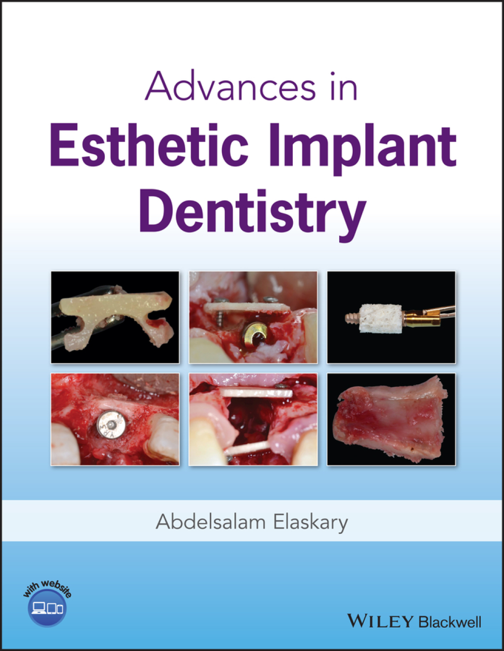 Advances in Esthetic Implant Dentistry 1st Edition â€“ PDF/EPUB Version Downloadable