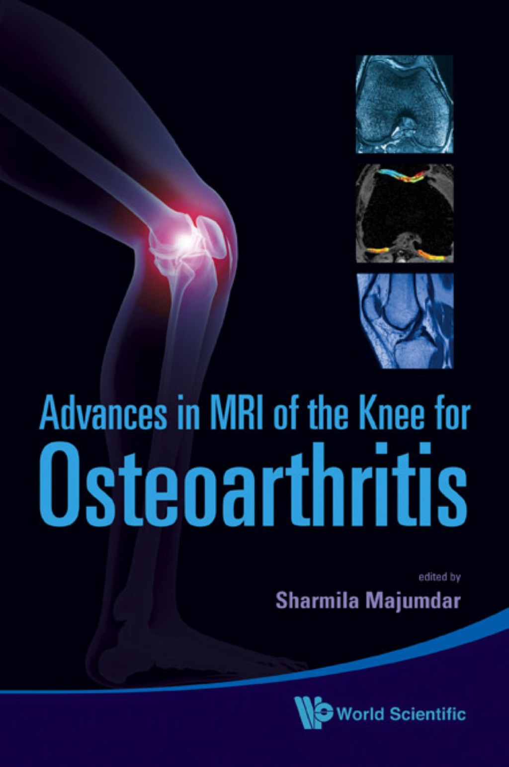 Advances In Mri Of The Knee For Osteoarthritis â€“ PDF/EPUB Version ...