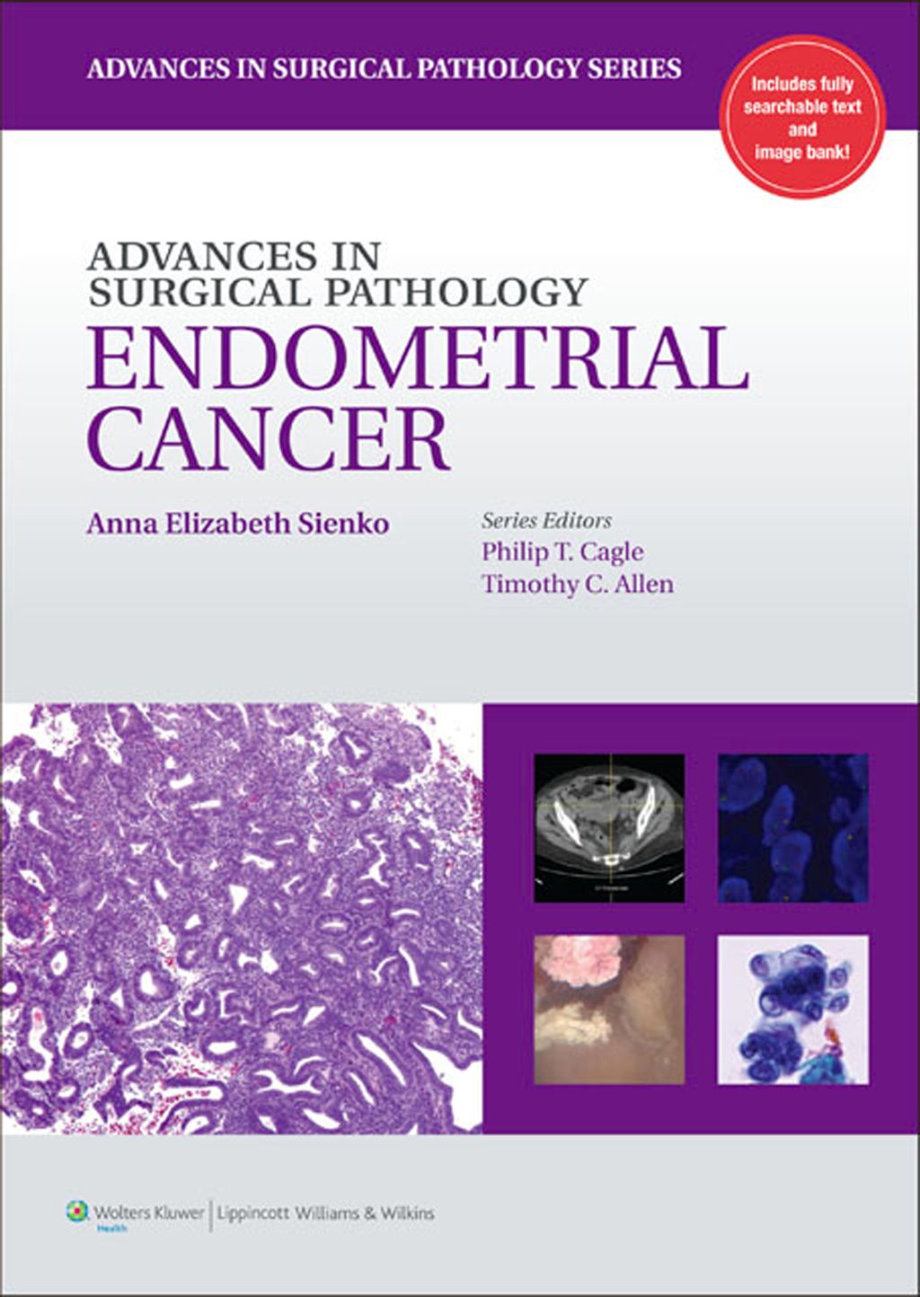 Advances in Surgical Pathology: Endometrial Carcinoma 1st Edition â€“ PDF/EPUB Version Downloadable
