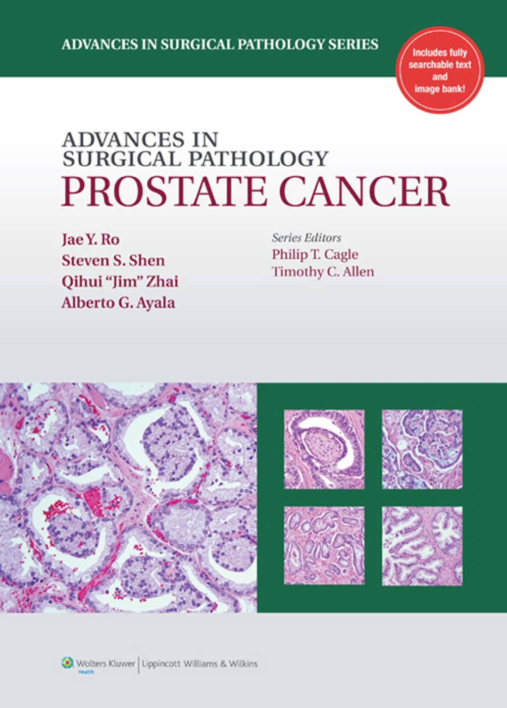 Advances in Surgical Pathology: Prostate Cancer 1st Edition â€“ PDF/EPUB Version Downloadable