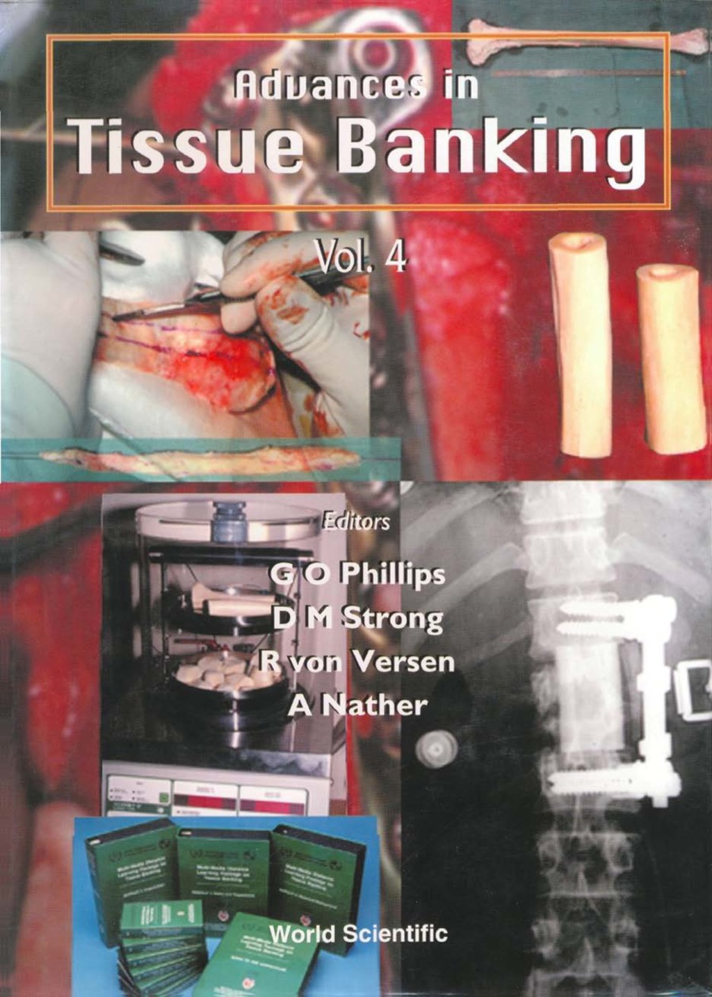 ADVANCES IN TISSUE BANKING (V4) â€“ PDF/EPUB Version Downloadable