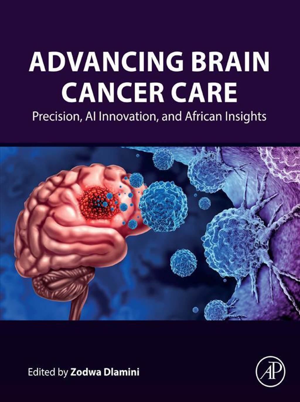 Advancing Brain Cancer Care Precision, AI Innovation, and African Insights â€“ PDF/EPUB Version Downloadable