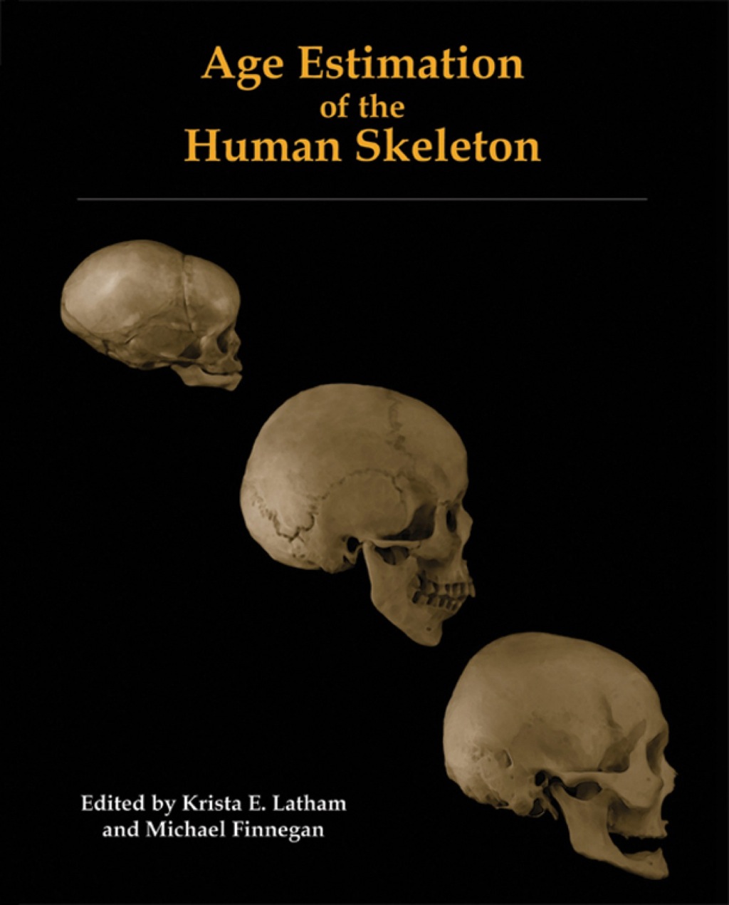Age Estimation of the Human Skeleton 1st Edition â€“ PDF/EPUB Version Downloadable