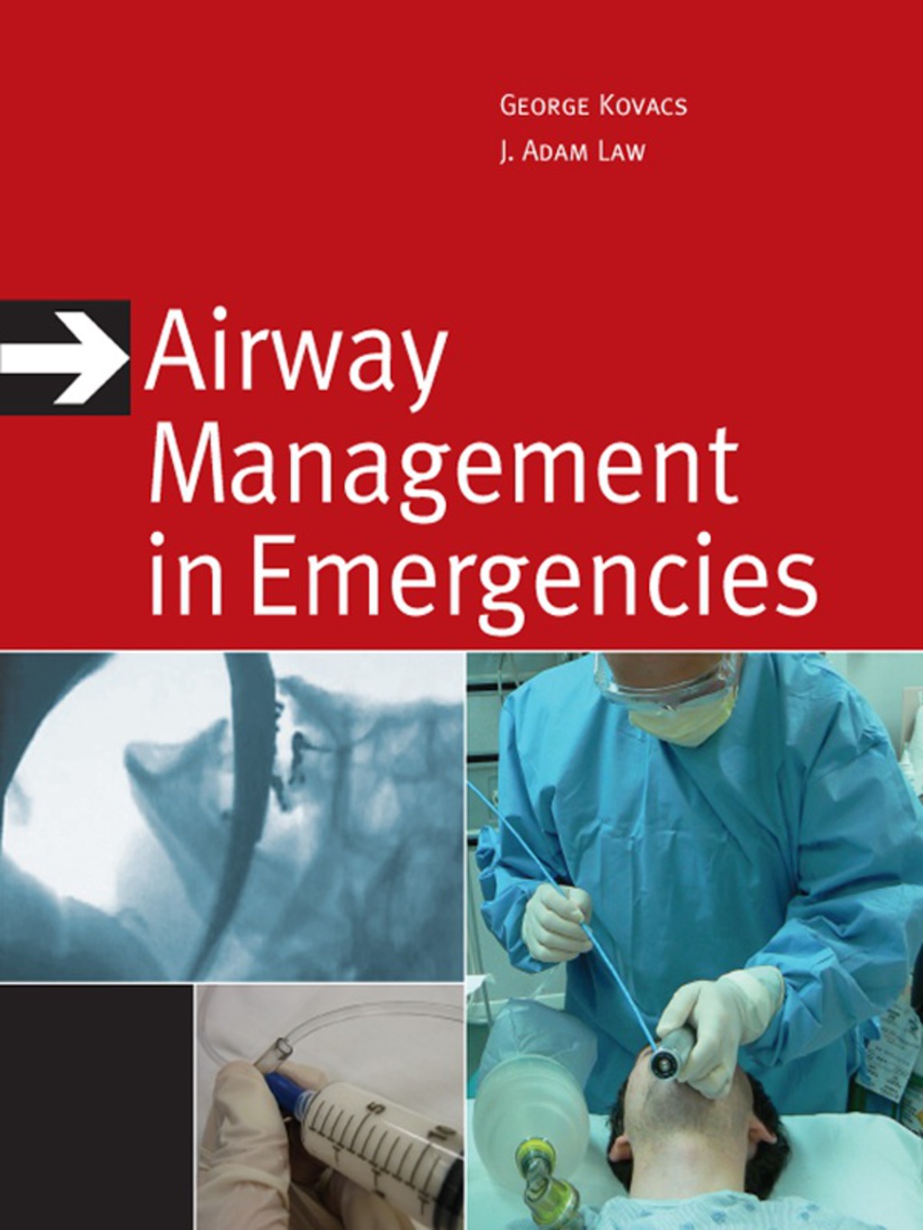 Airway Management in Emergencies 1st Edition â€“ PDF/EPUB Version Downloadable