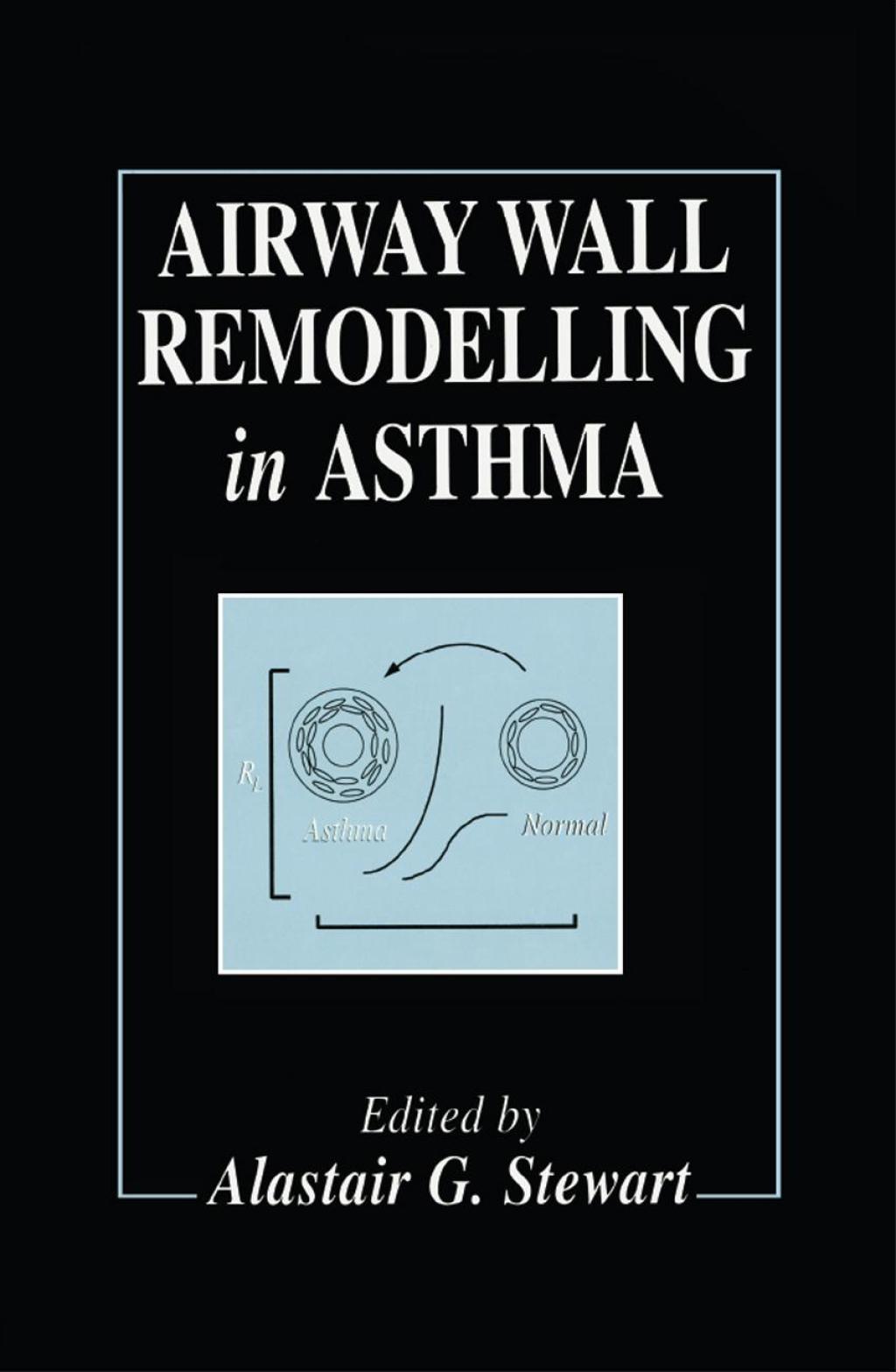Airway Wall Remodelling in Asthma 1st Edition â€“ PDF/EPUB Version Downloadable