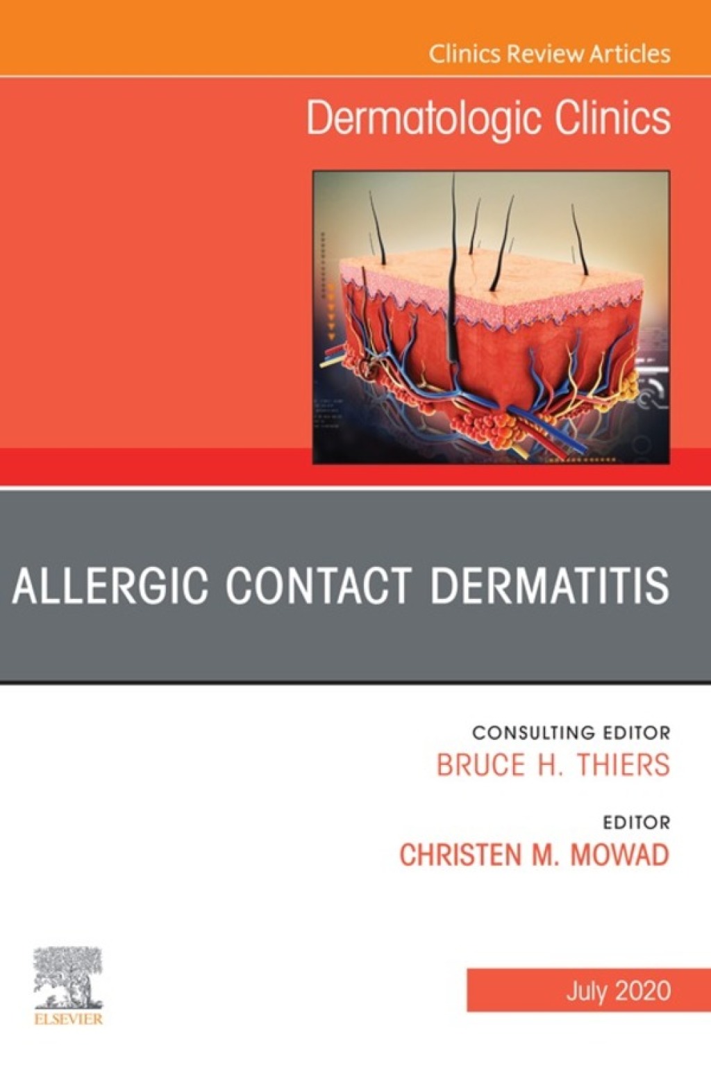 Allergic Contact Dermatitis,An Issue of Dermatologic Clinics  â€“ PDF/EPUB Version Downloadable