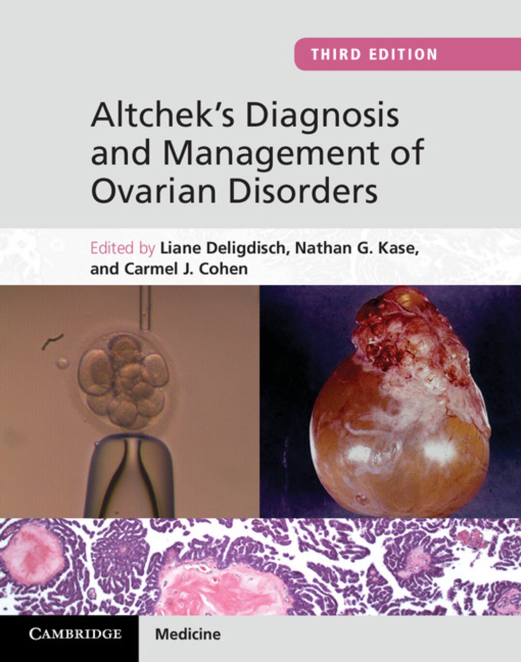 Altchek's Diagnosis and Management of Ovarian Disorders 3rd Edition â€“ PDF/EPUB Version Downloadable