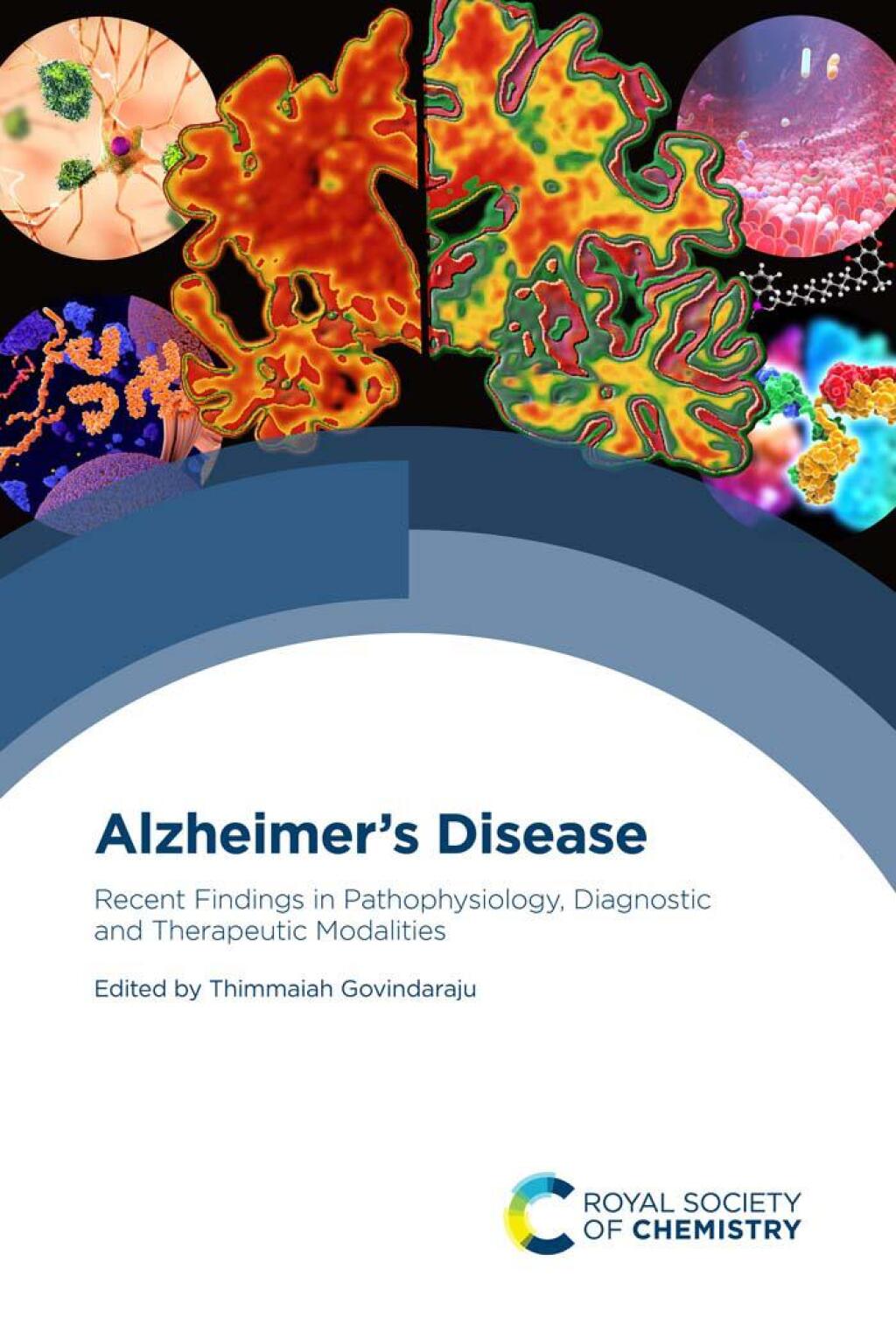 Alzheimer's Disease Recent Findings in Pathophysiology, Diagnostic and Therapeutic Modalities 1st Edition â€“ PDF/EPUB Version Downloadable