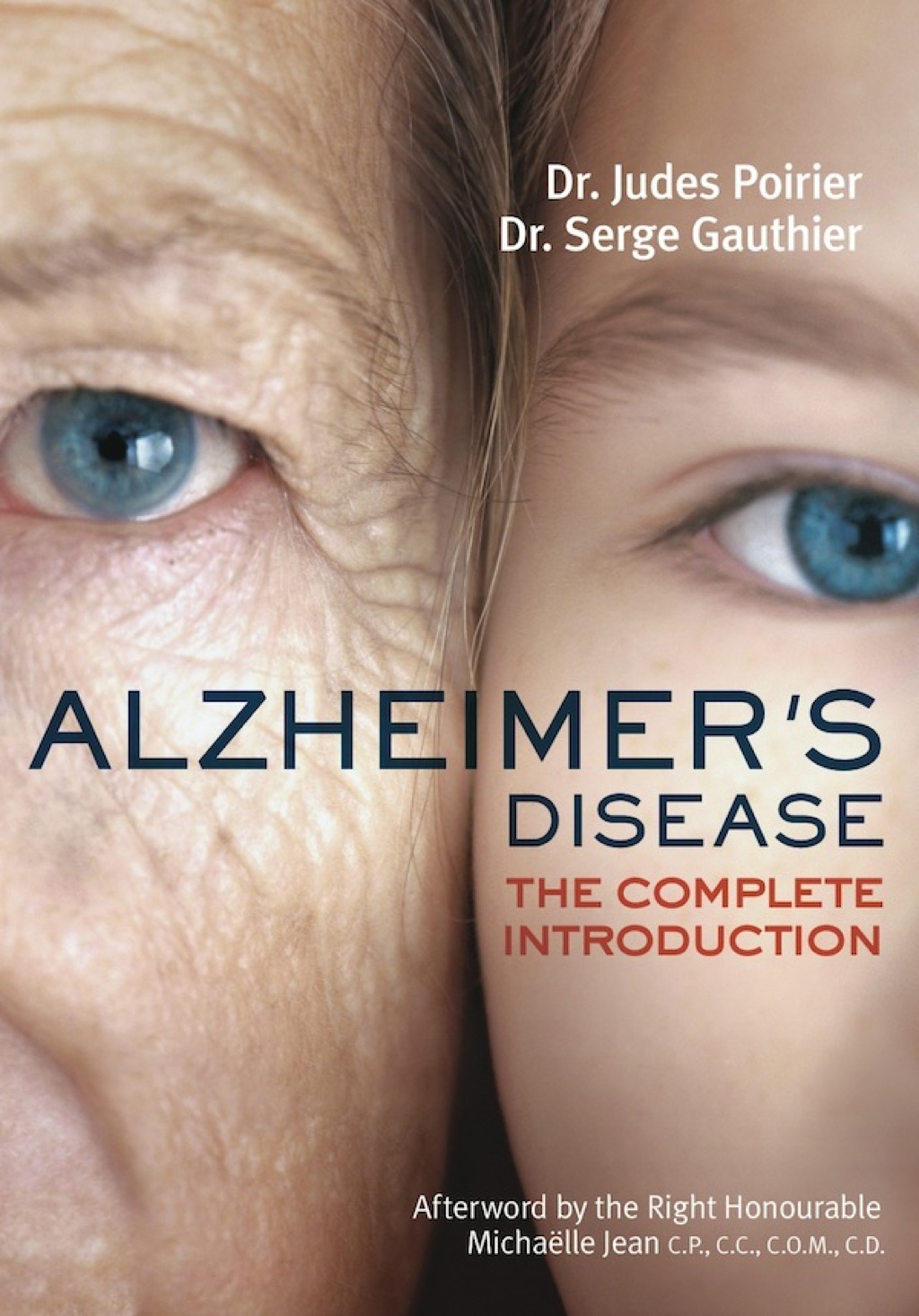 Alzheimer's Disease The Complete Introduction - (PDF/EPUB Version)