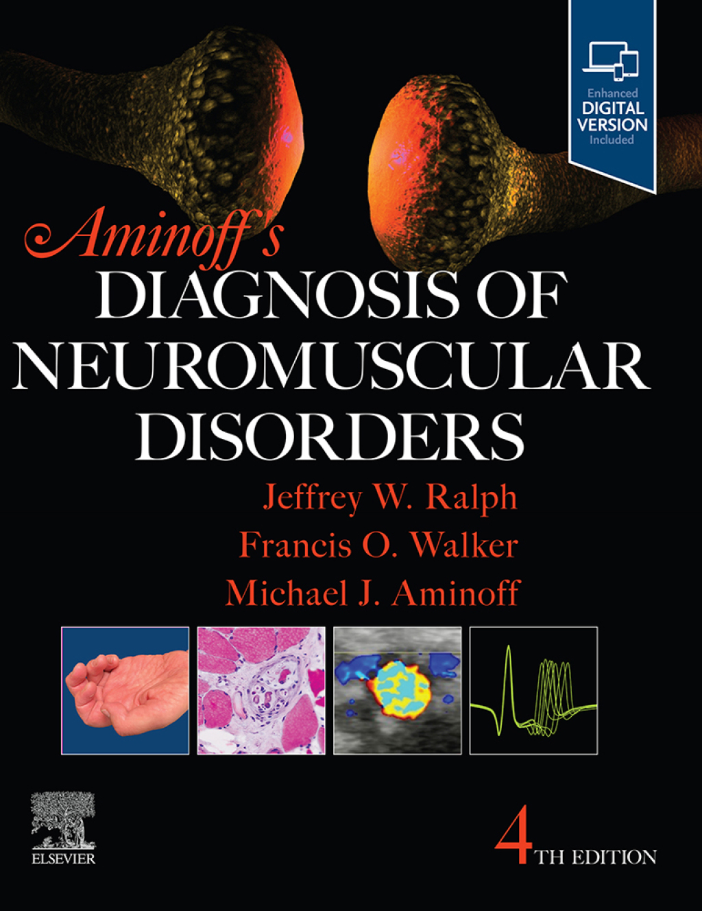 Aminoff's Diagnosis of Neuromuscular Disorders 4th Edition â€“ PDF/EPUB Version Downloadable