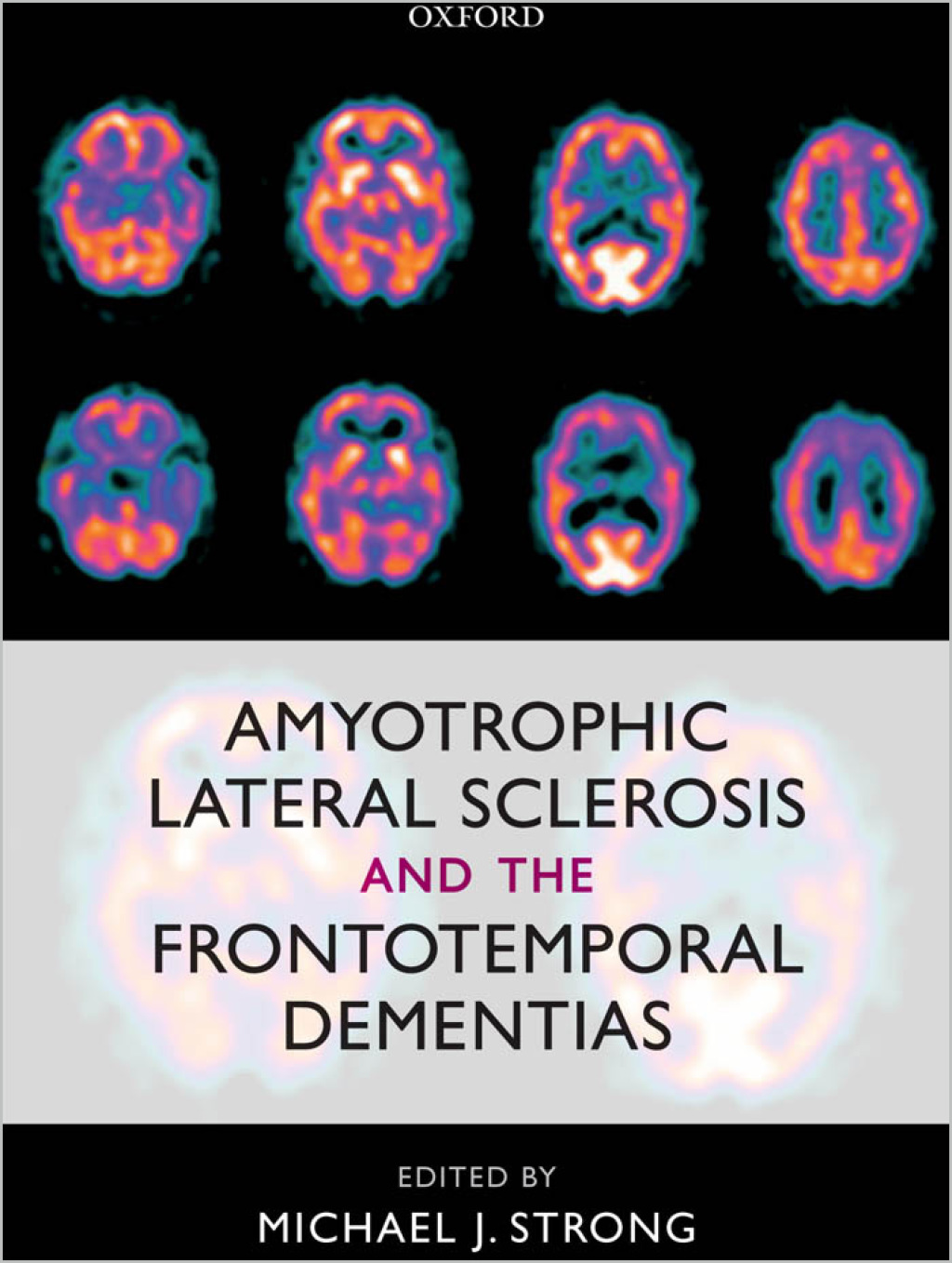 Amyotrophic Lateral Sclerosis and the Frontotemporal Dementias 1st Edition â€“ PDF/EPUB Version Downloadable