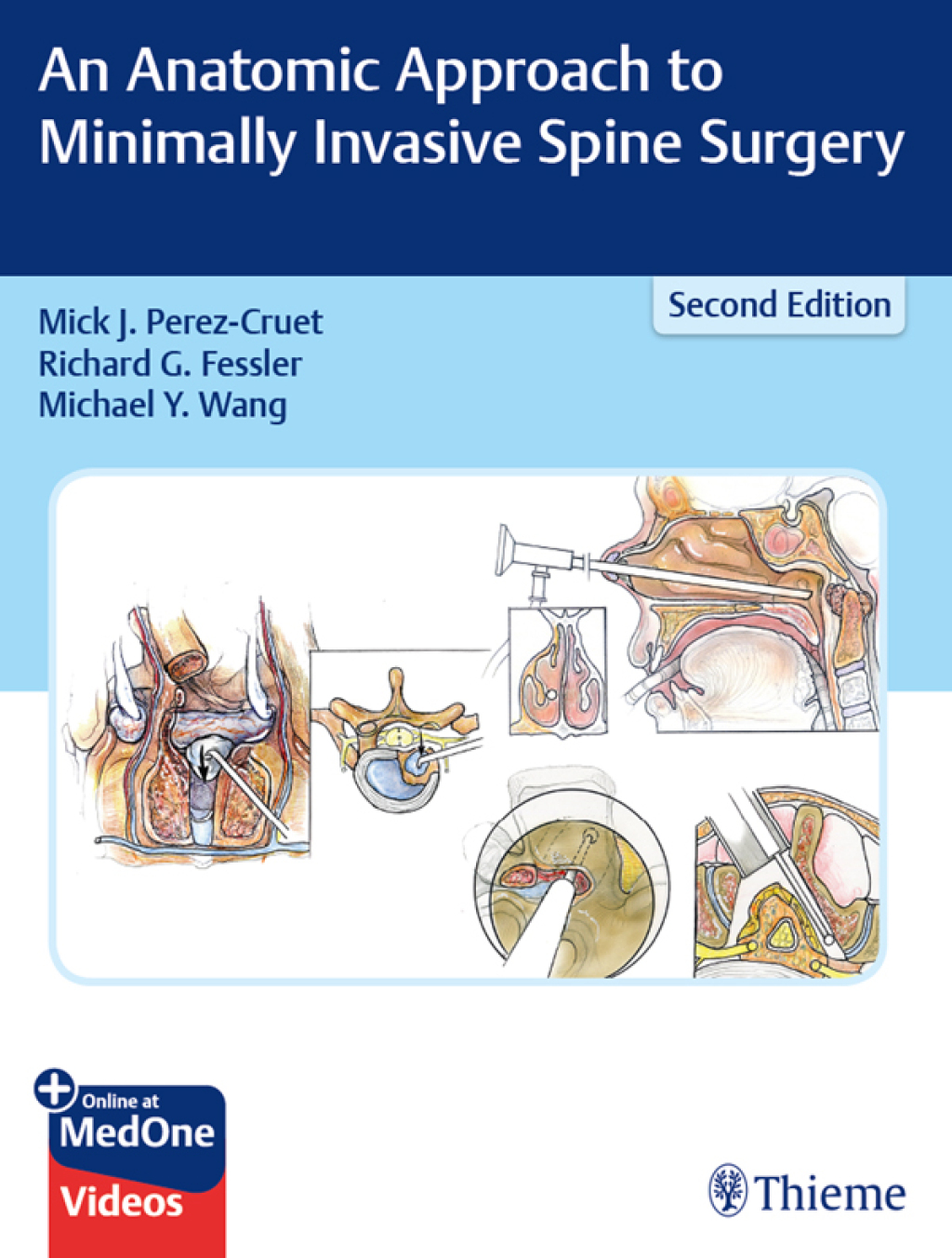 An Anatomic Approach to Minimally Invasive Spine Surgery 2nd Edition â€“ PDF/EPUB Version Downloadable