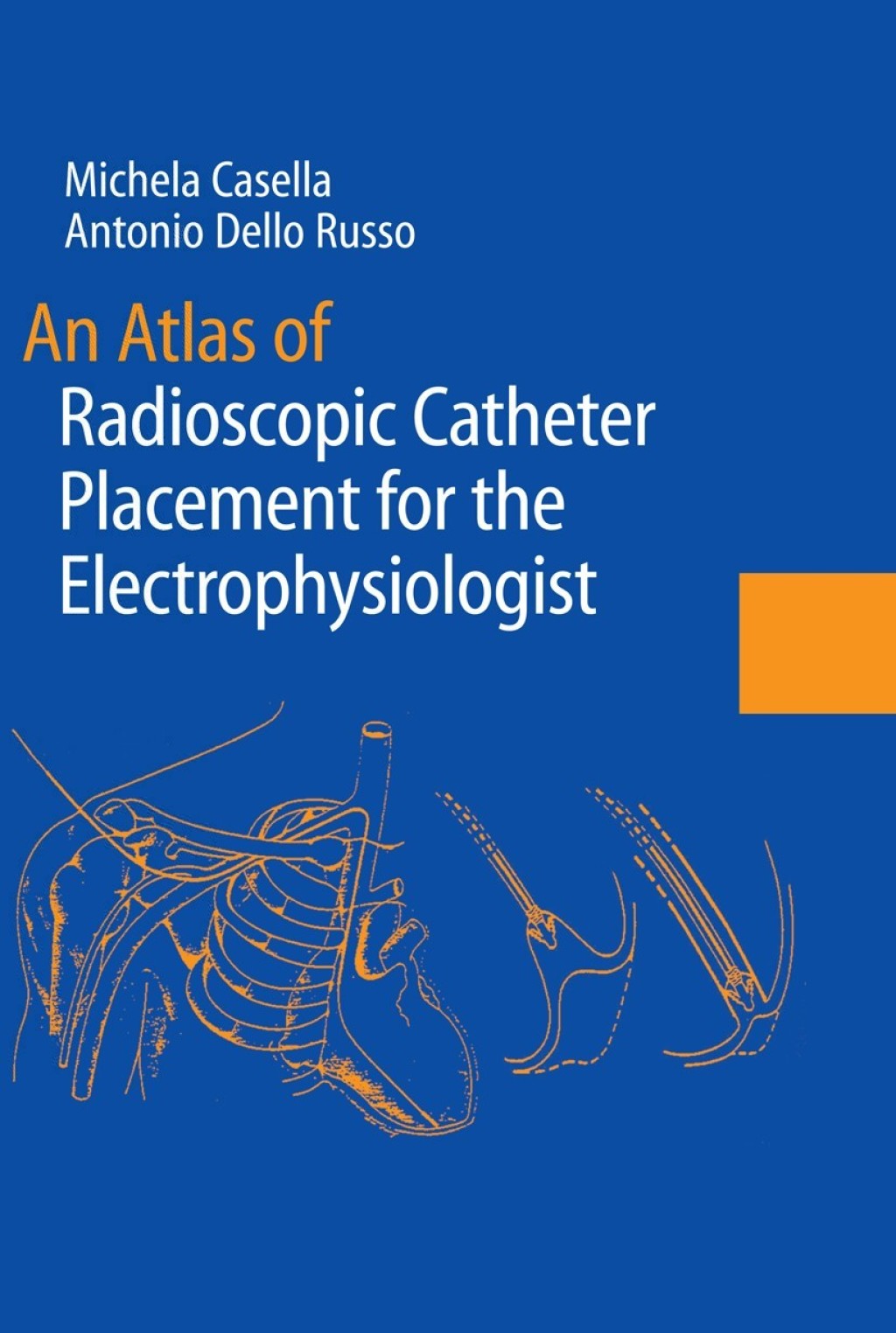 An Atlas of Radioscopic Catheter Placement for the Electrophysiologist 1st Edition â€“ PDF/EPUB Version Downloadable