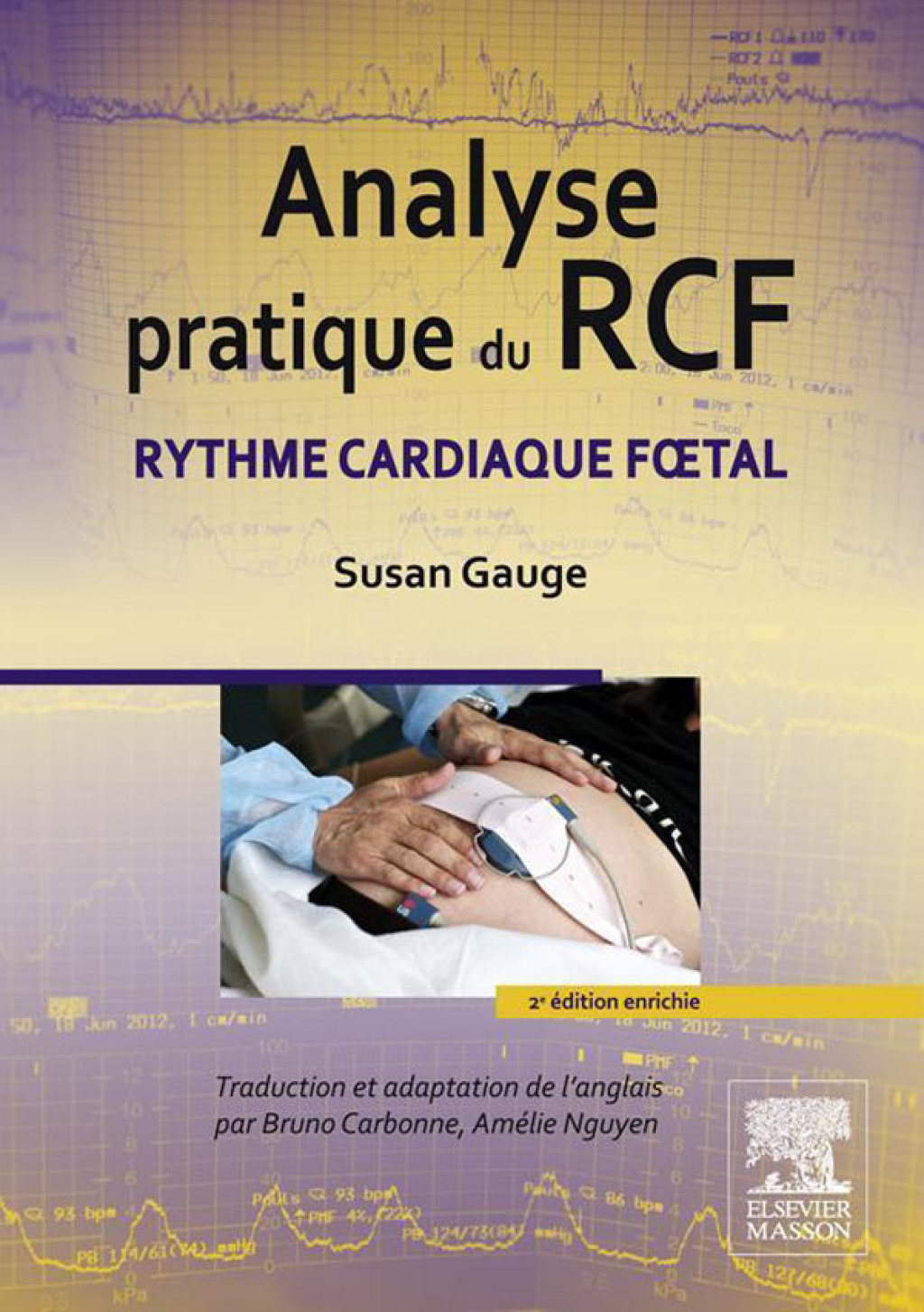 Analyse pratique du RCF Rythme cardiaque fÅ“tal 2nd Edition - (PDF/EPUB Version)