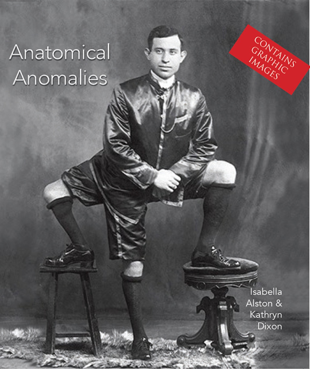 Anatomical Anomalies - (PDF/EPUB Version)
