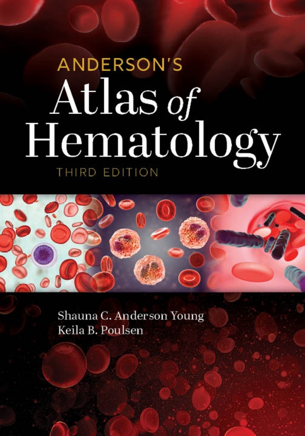 Anderson's Atlas of Hematology 3rd Edition â€“ PDF/EPUB Version Downloadable