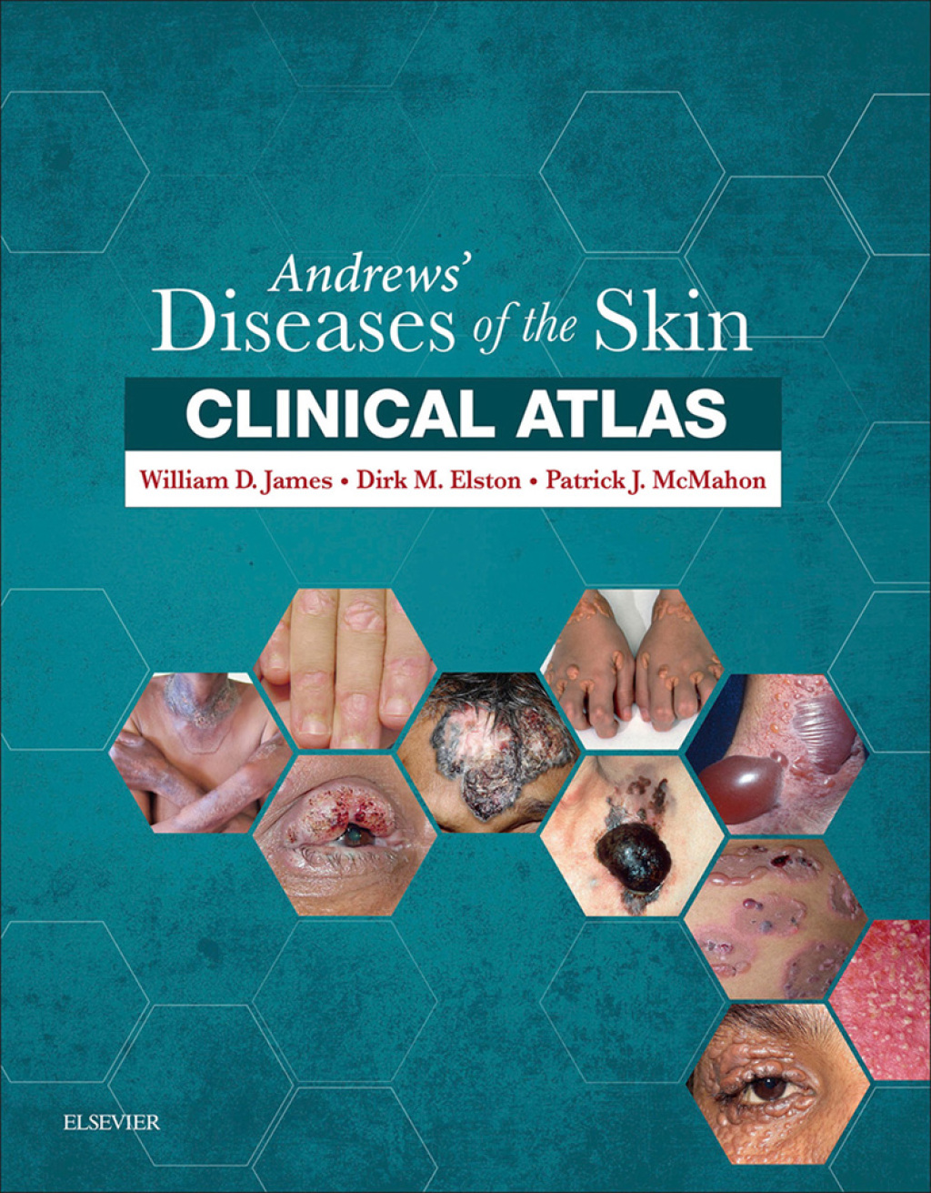 Andrews' Diseases of the Skin Clinical Atlas - Electronic 1st Edition â€“ PDF/EPUB Version Downloadable
