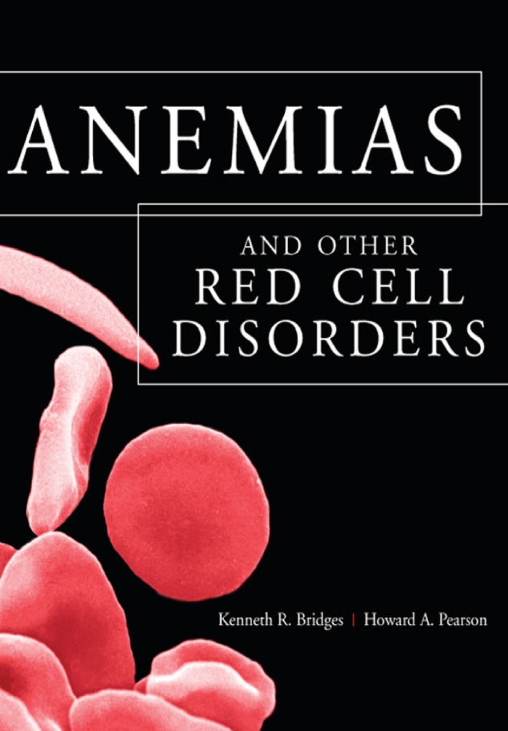 Anemias and Other Red Cell Disorders 1st Edition â€“ PDF/EPUB Version Downloadable