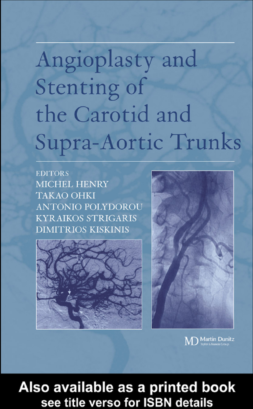 Angioplasty and Stenting of Carotid and Supra-aortic Trunks 1st Edition â€“ PDF/EPUB Version Downloadable