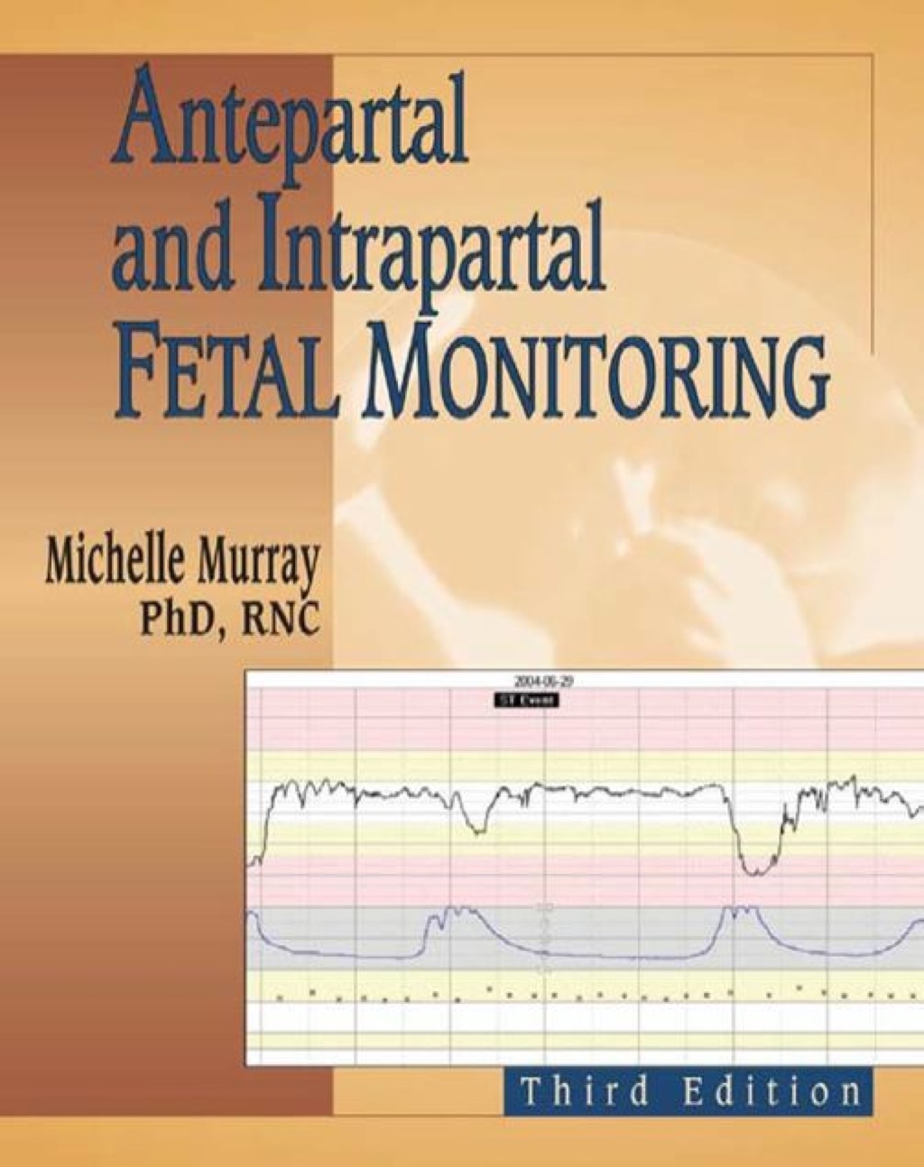 Antepartal and Intrapartal Fetal Monitoring Third Edition 3rd Edition â€“ PDF/EPUB Version Downloadable