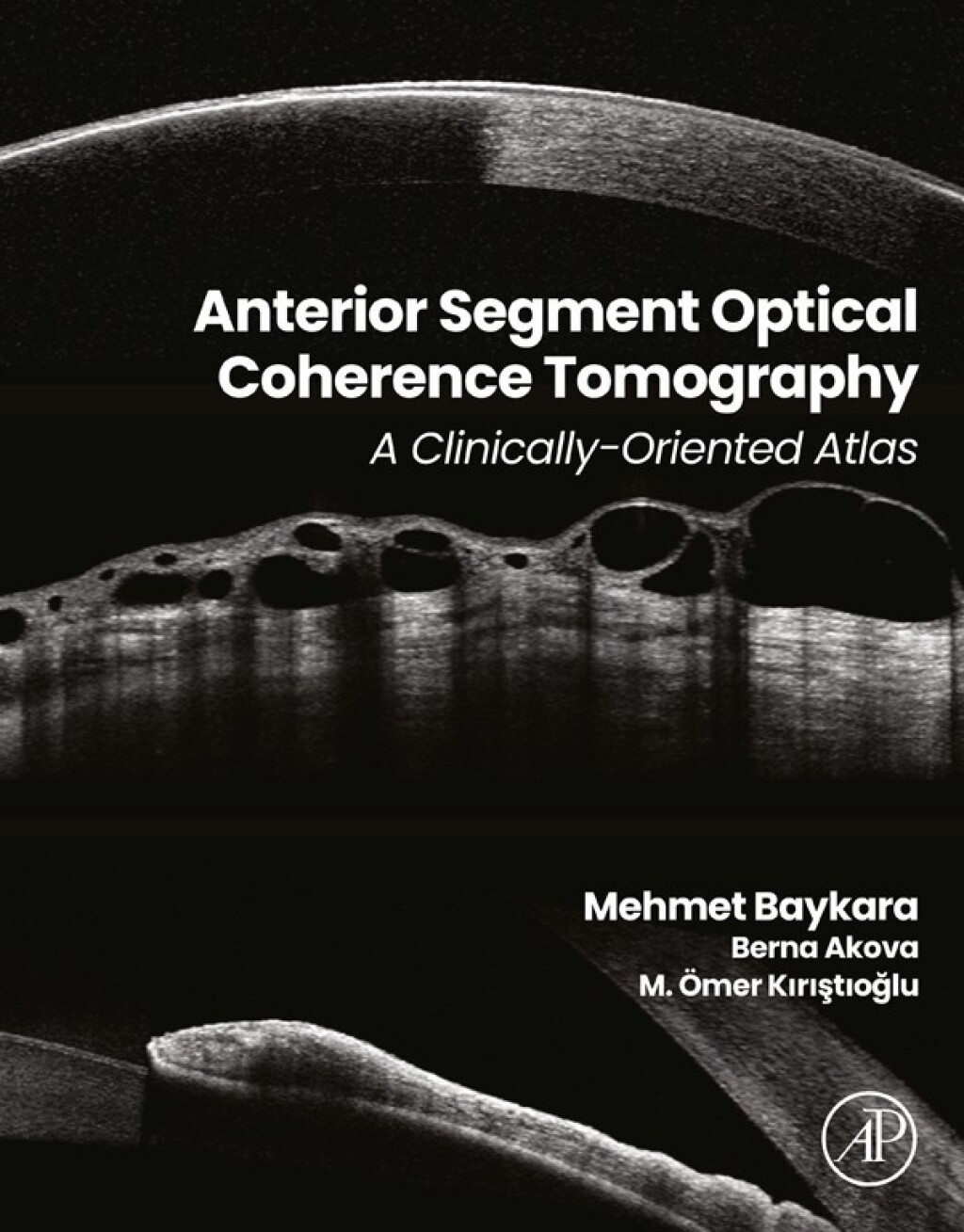 Anterior Segment Optical Coherence Tomography A Clinically-Oriented Atlas â€“ PDF/EPUB Version Downloadable