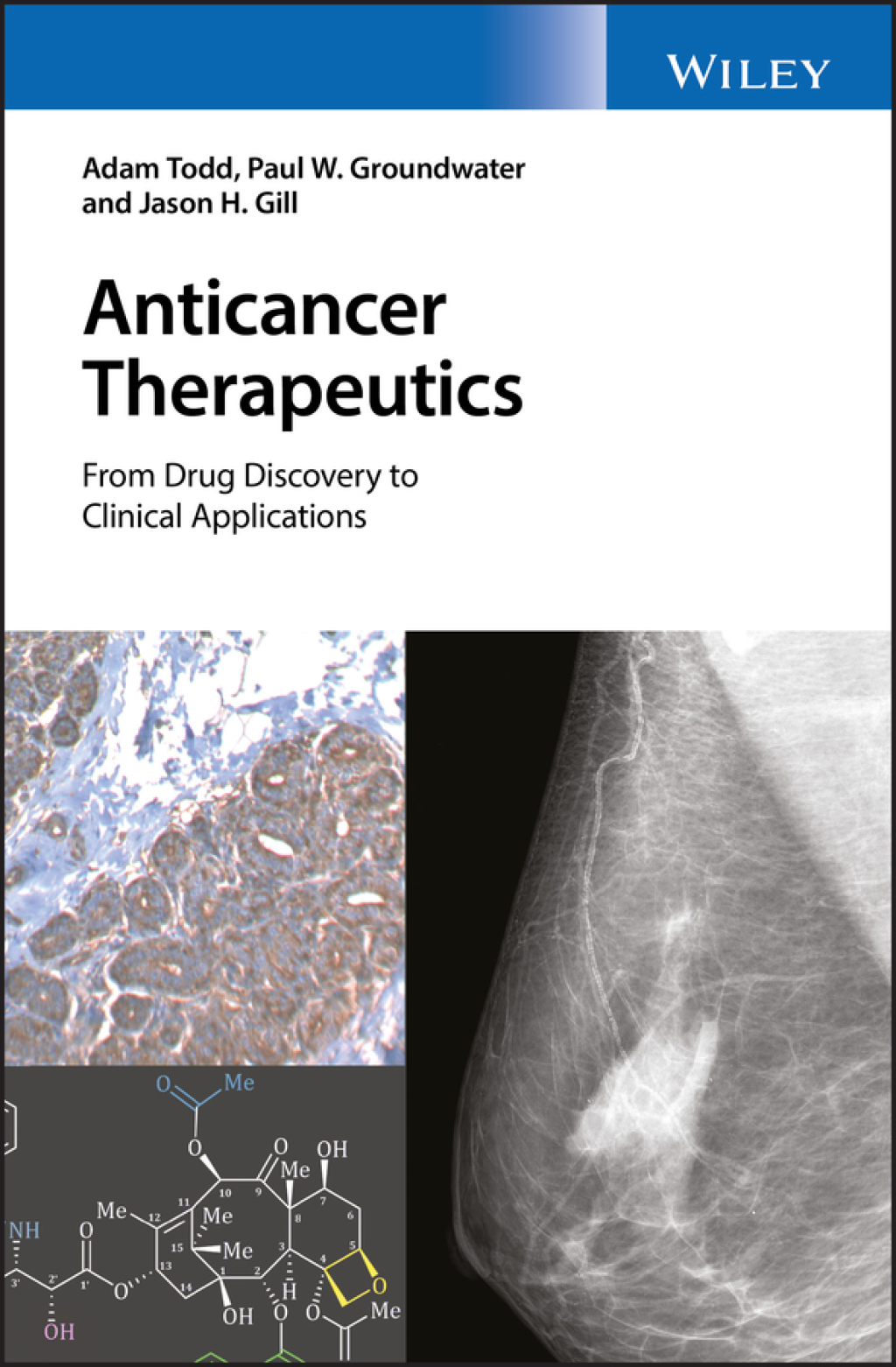 Anticancer Therapeutics: From Drug Discovery to Clinical Applications 1st Edition â€“ PDF/EPUB Version Downloadable