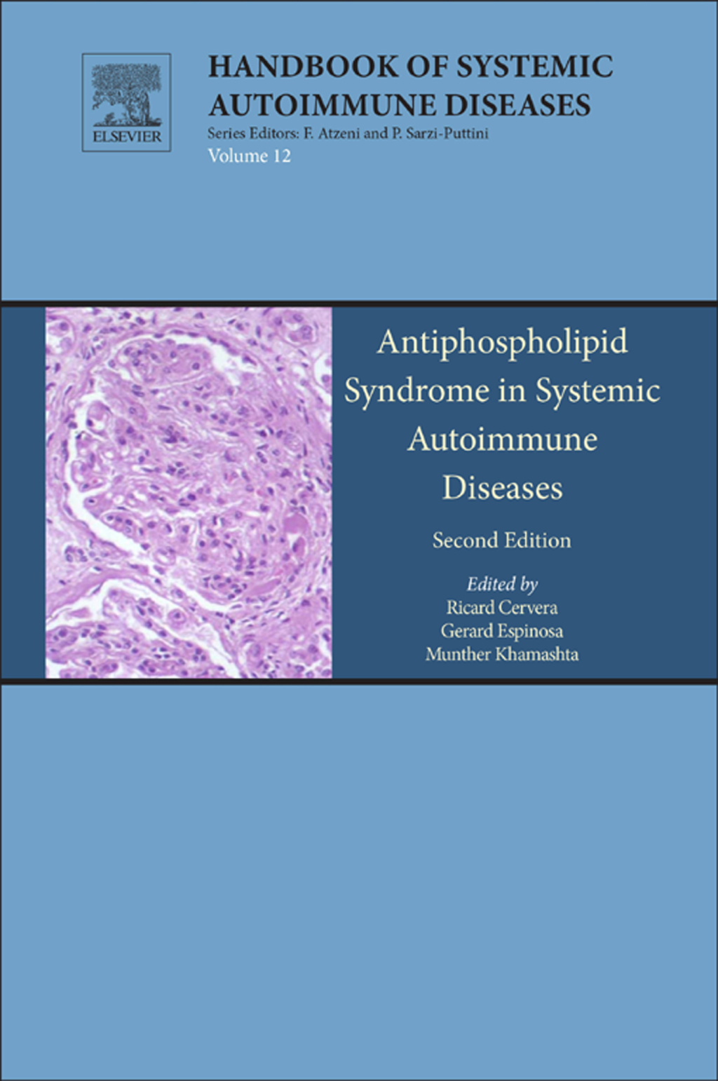 Antiphospholipid Syndrome in Systemic Autoimmune Diseases 2nd Edition â€“ PDF/EPUB Version Downloadable