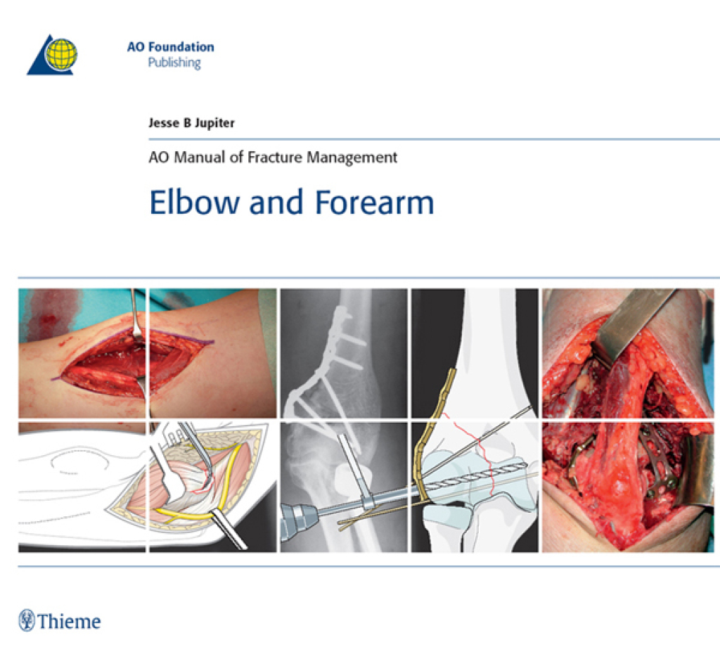 AO Manual of Fracture Management – Hand and Wrist 1st Edition â€“ PDF/EPUB Version Downloadable ...