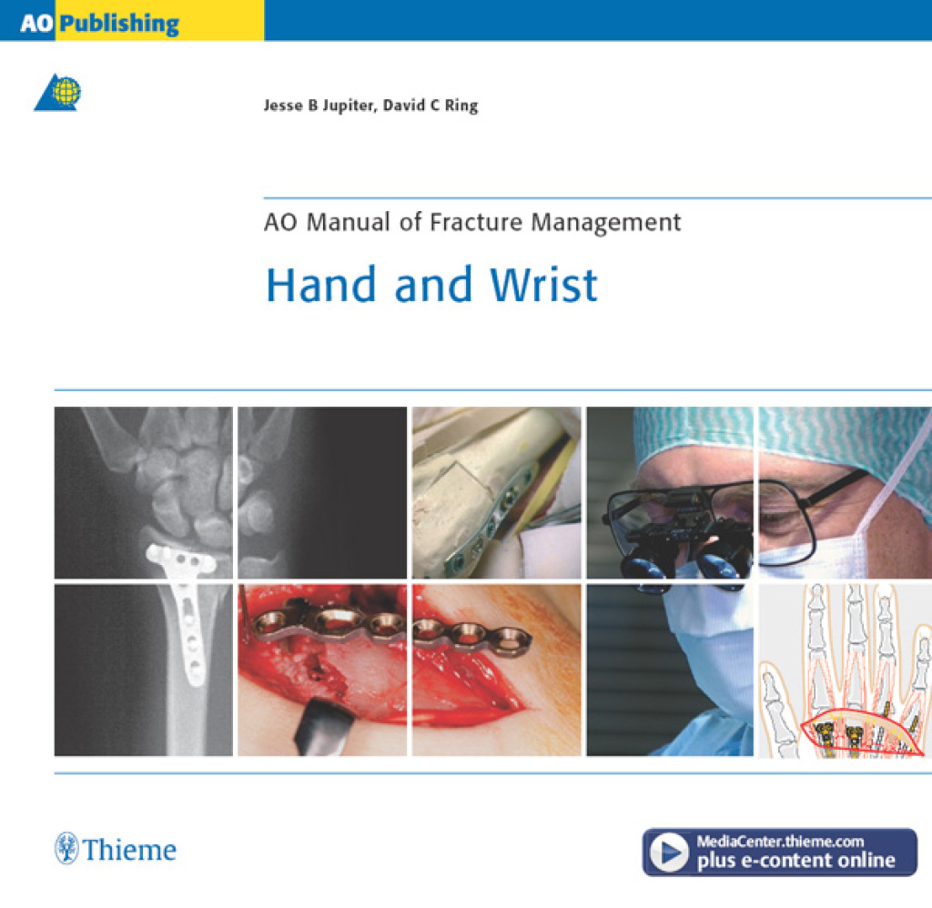 AO Manual of Fracture Management – Hand and Wrist 1st Edition â€“ PDF/EPUB Version Downloadable ...