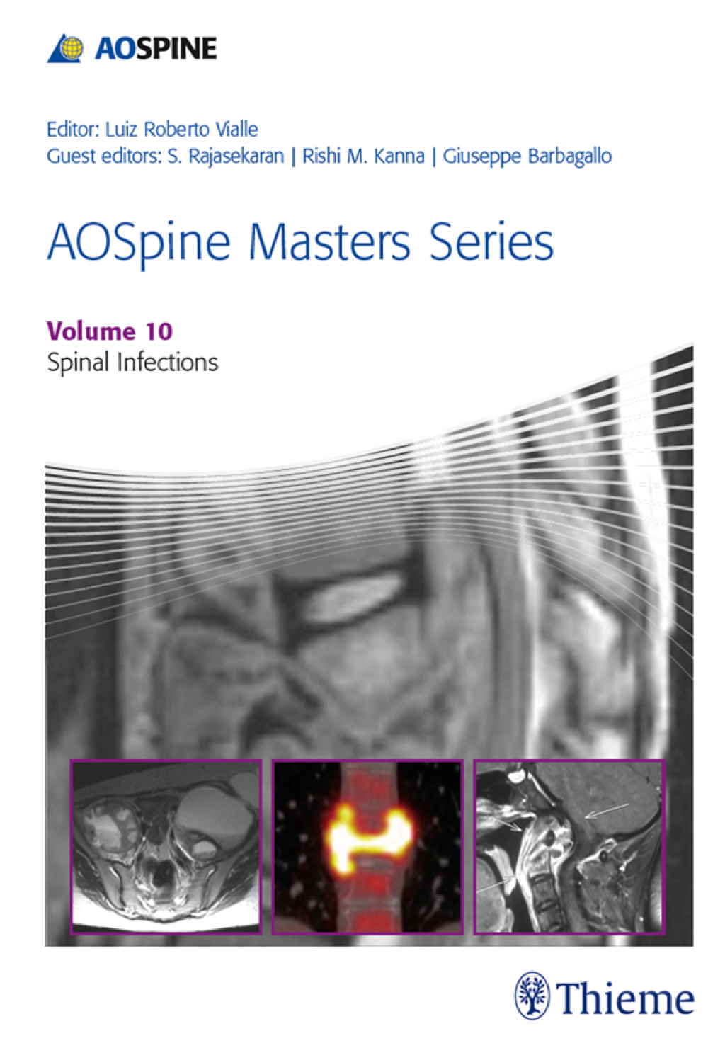AOSpine Masters Series, Volume 10: Spinal Infections 1st Edition â€“ PDF/EPUB Version Downloadable