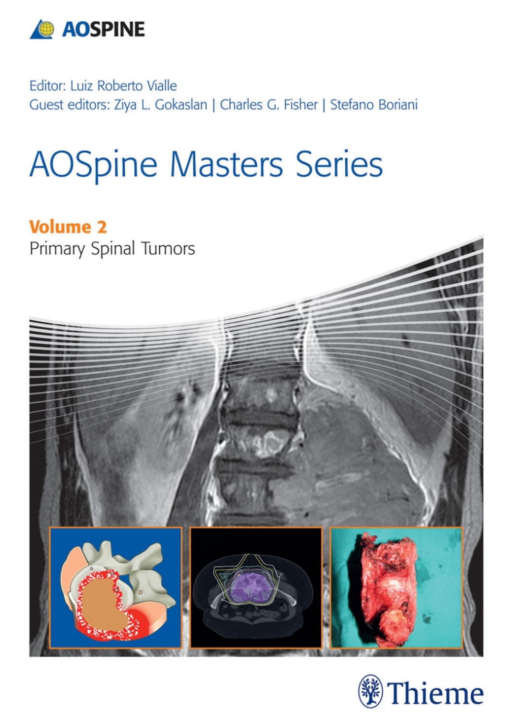 AOSpine Masters Series, Volume 2: Primary Spinal Tumors 1st Edition – PDF/EPUB Version Downloadable AOSpine Masters Series, Volume 2: Primary Spinal Tumors 1st Edition – PDF/EPUB Version Downloadable - Image 1