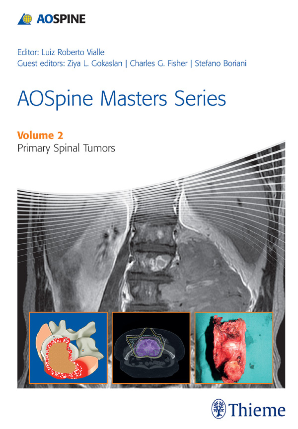 AOSpine Masters Series, Volume 2: Primary Spinal Tumors 1st Edition â€“ PDF/EPUB Version Downloadable