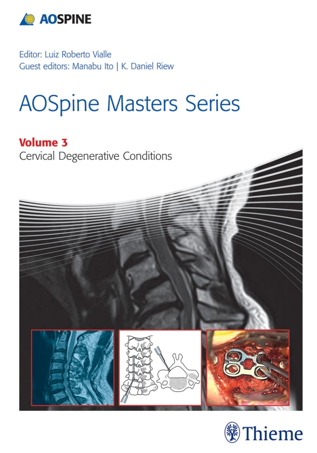 AOSpine Masters Series, Volume 3: Cervical Degenerative Conditions 1st Edition â€“ PDF/EPUB Version Downloadable