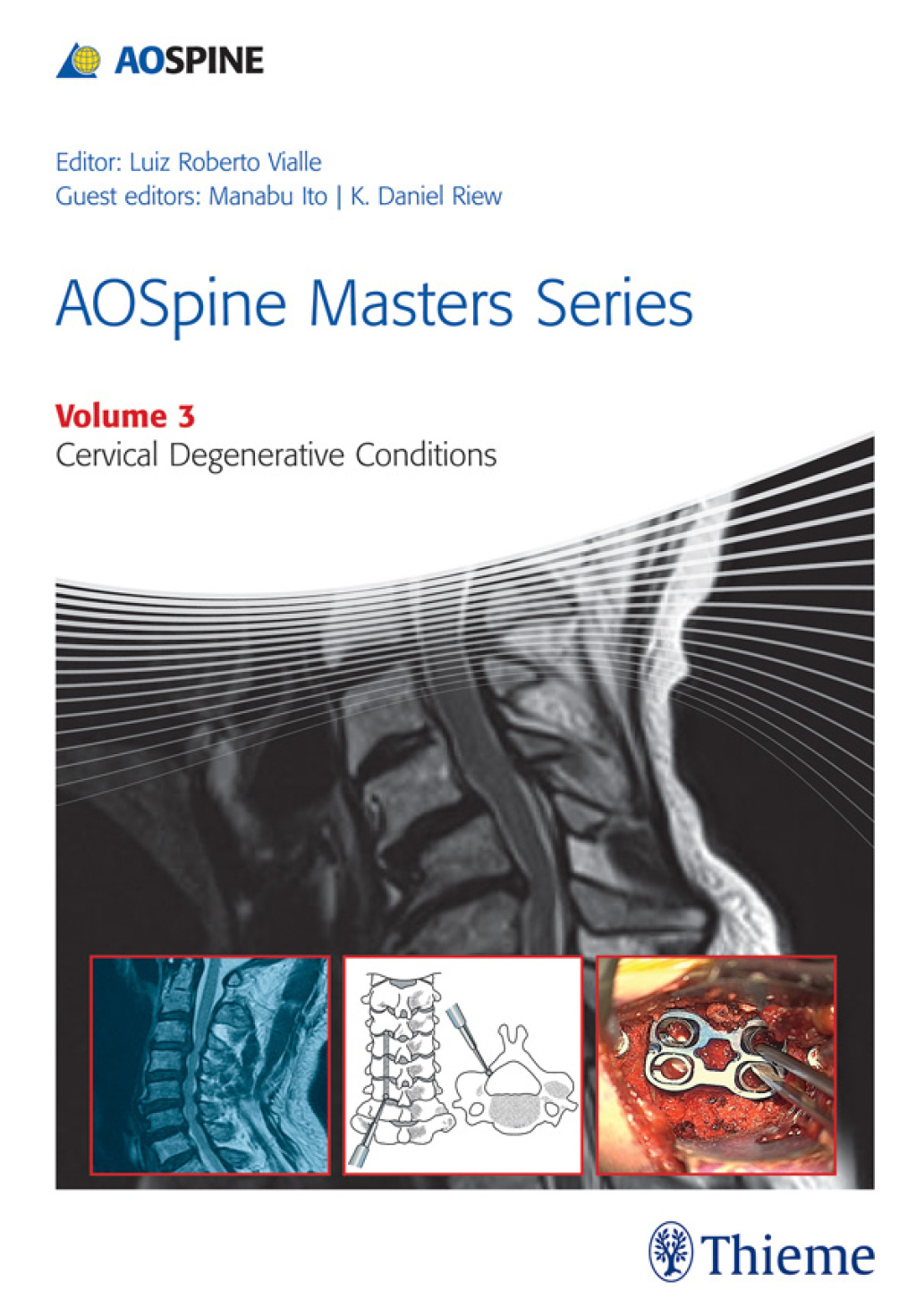 AOSpine Masters Series, Volume 3: Cervical Degenerative Conditions 1st Edition â€“ PDF/EPUB Version Downloadable