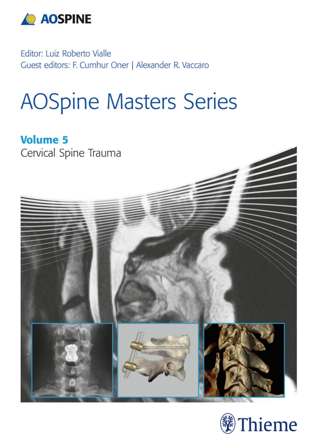 AOSpine Masters Series, Volume 5: Cervical Spine Trauma 1st Edition â€“ PDF/EPUB Version Downloadable