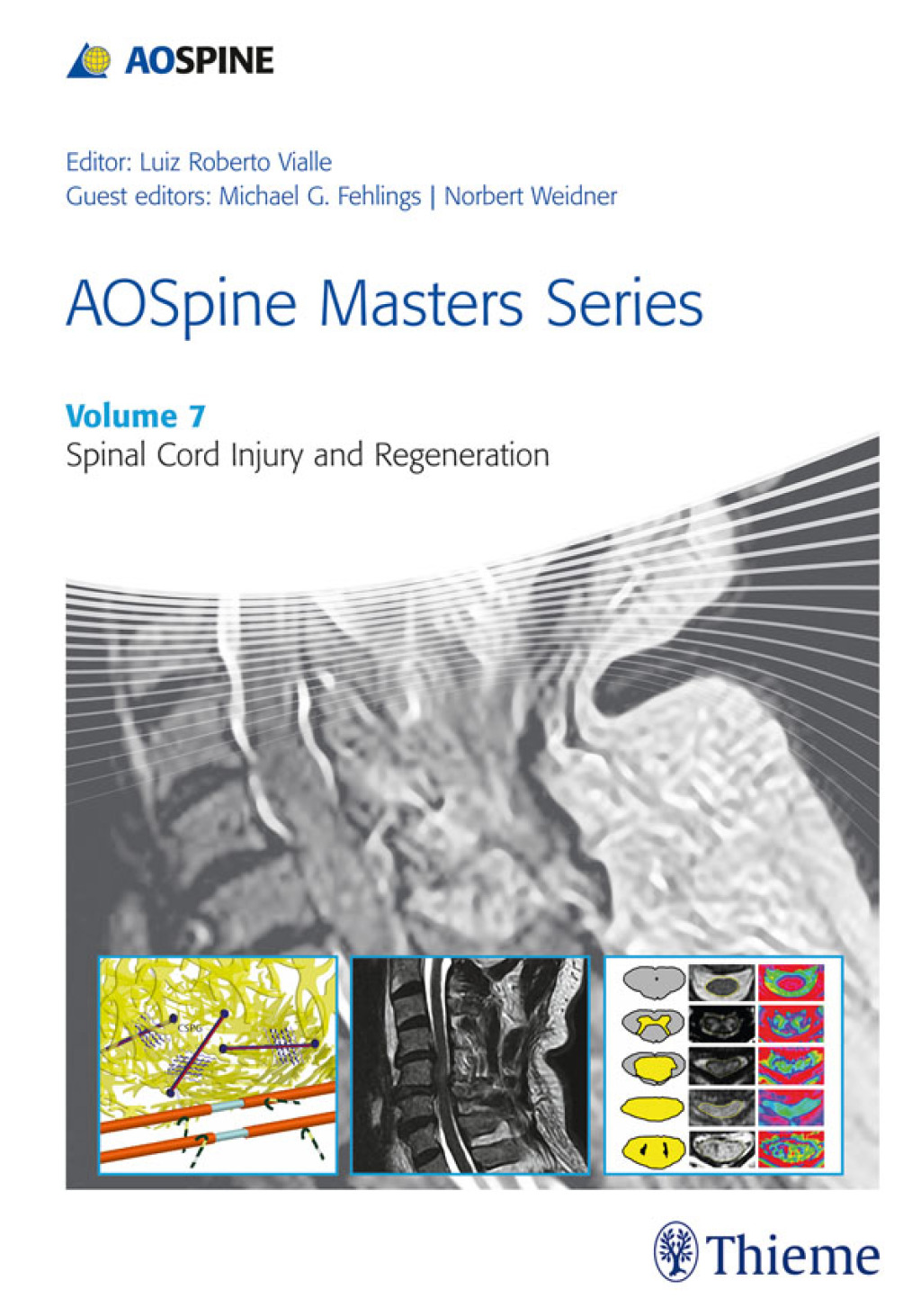 AOSpine Masters Series, Volume 7: Spinal Cord Injury and Regeneration 1st Edition â€“ PDF/EPUB Version Downloadable