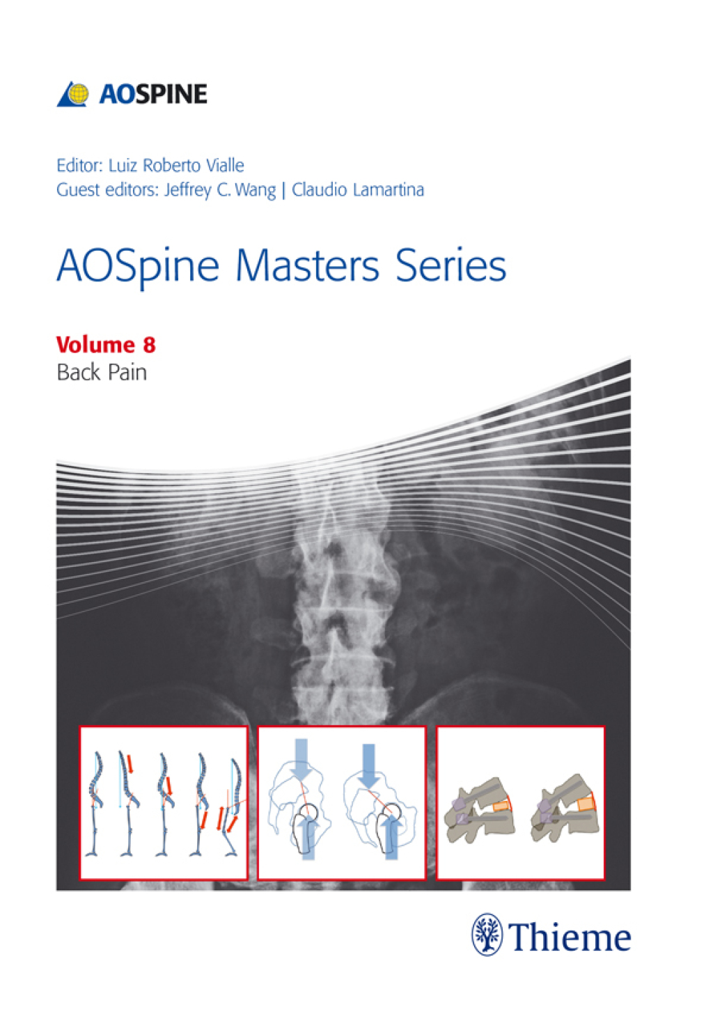 AOSpine Masters Series, Volume 8: Back Pain 1st Edition â€“ PDF/EPUB Version Downloadable
