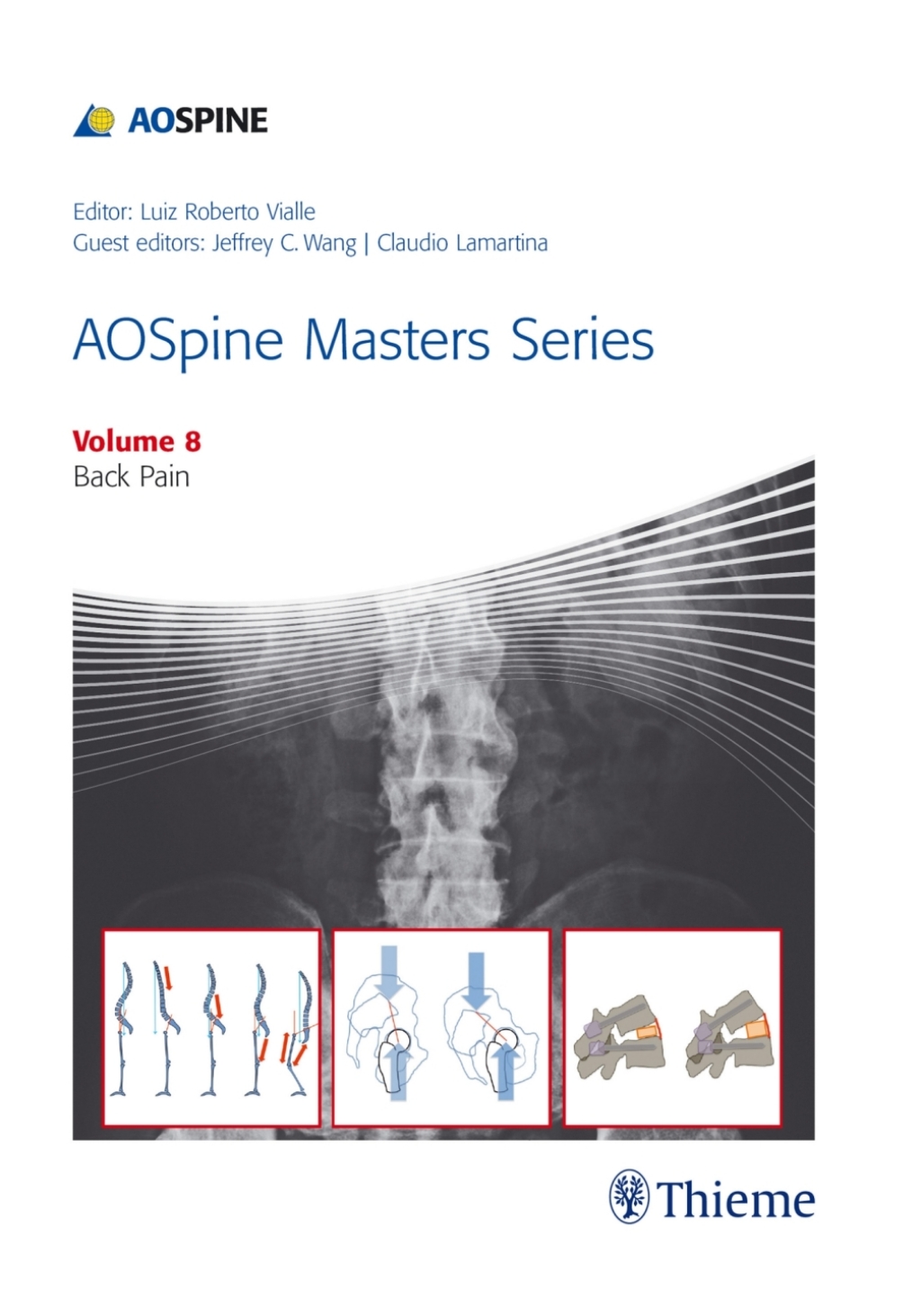 AOSpine Masters Series, Volume 8: Back Pain 1st Edition â€“ PDF/EPUB Version Downloadable