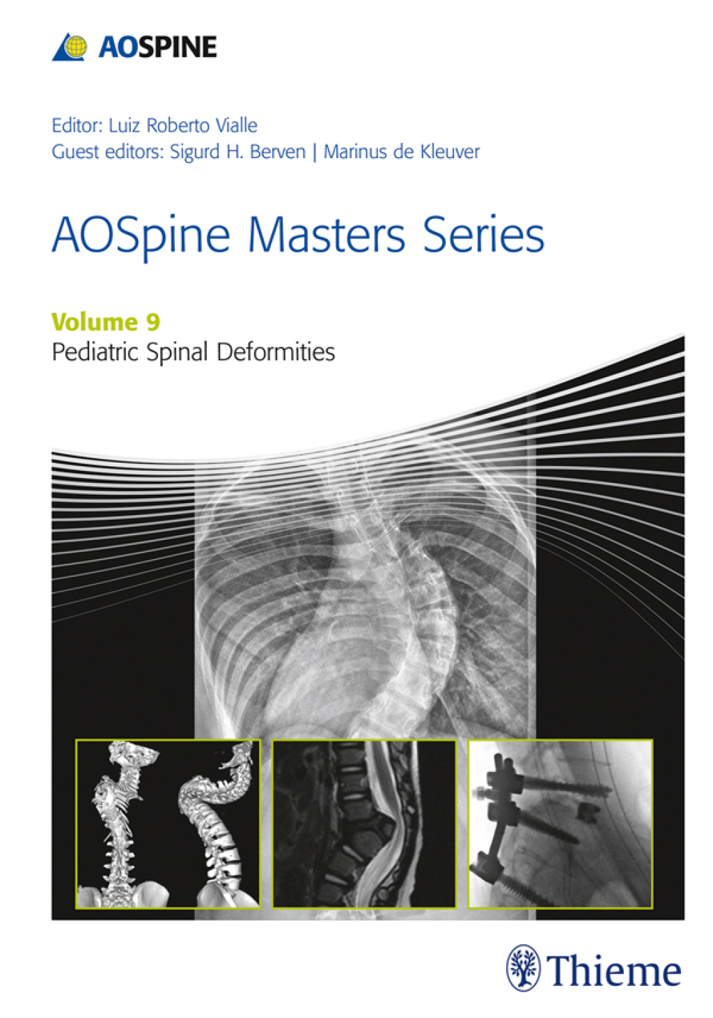 AOSpine Masters Series, Volume 9: Pediatric Spinal Deformities 1st Edition â€“ PDF/EPUB Version Downloadable